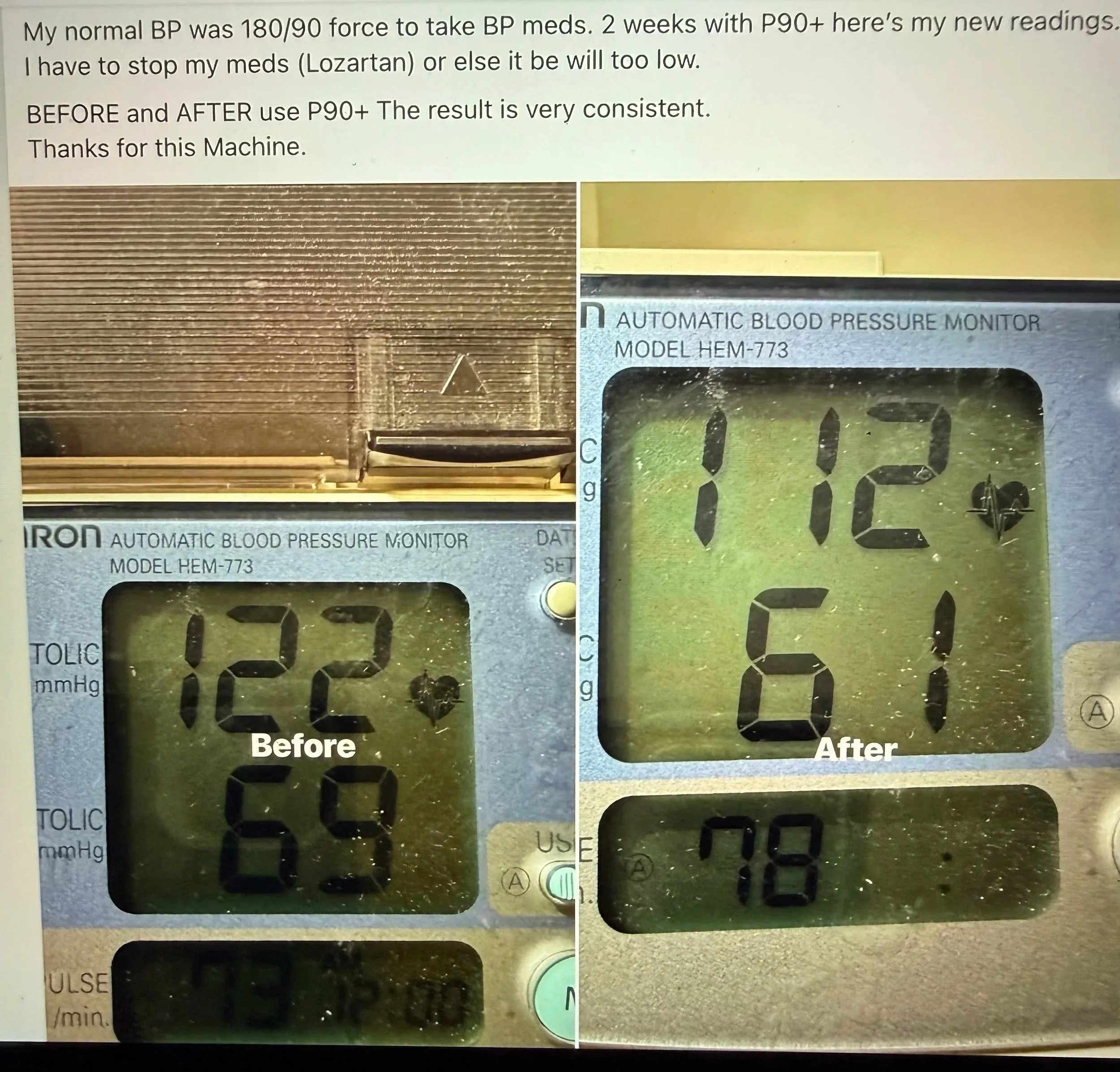 Before and after photos of a blood pressure monitor showing increased readings after using a P90+ device. The first photo labeled 'Before' shows a reading of 120/80 mmHg. The second photo labeled 'After' shows a reading of 142/102 mmHg.