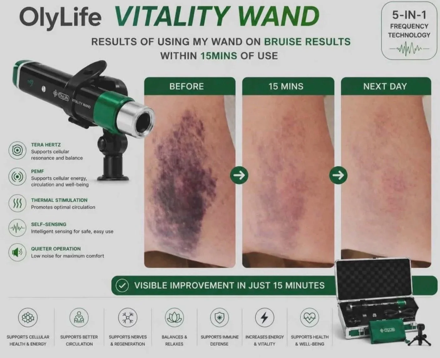 A bruise before and after 15 minutes of use, and the next day showing visible improvements.