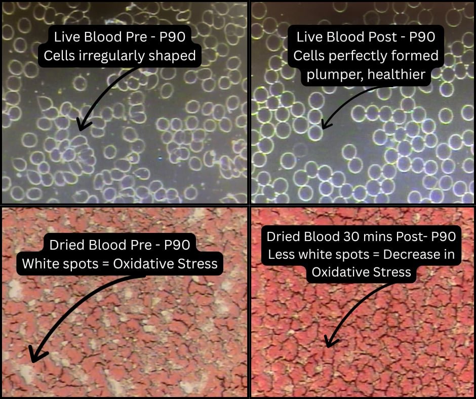 Before and after pictures of blood cells showing perfectly formed & healthier cells after usage.