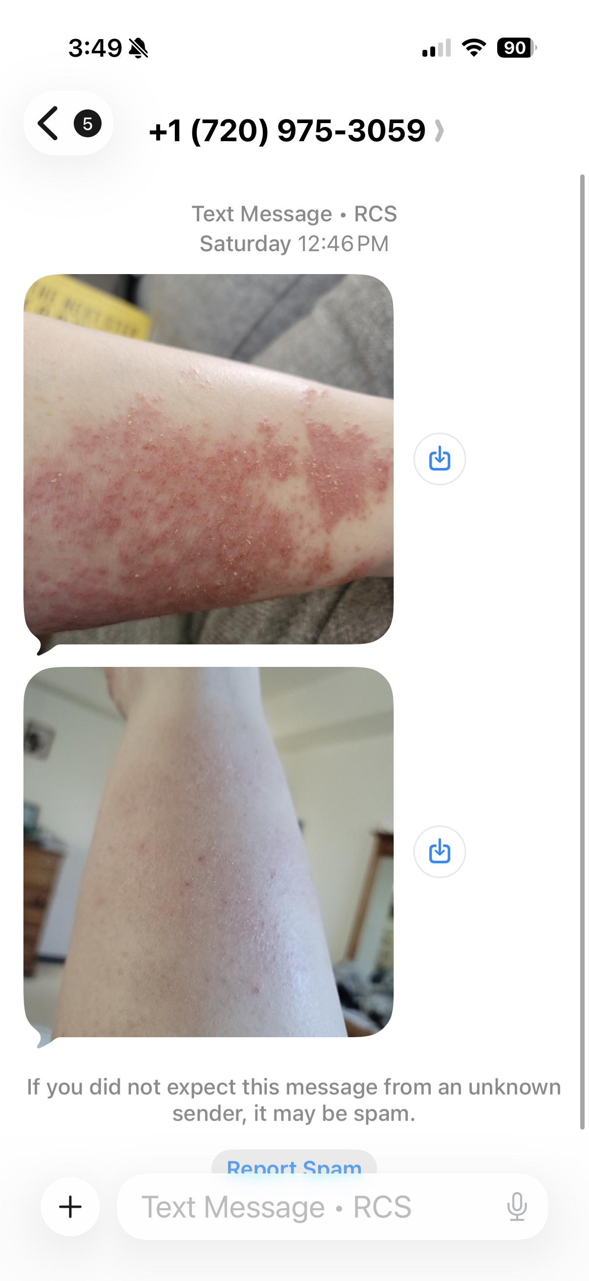 Close-up of a person's arm with red, inflamed, patchy skin and dry, peeling areas and a picture showing clearer skin without redness.
