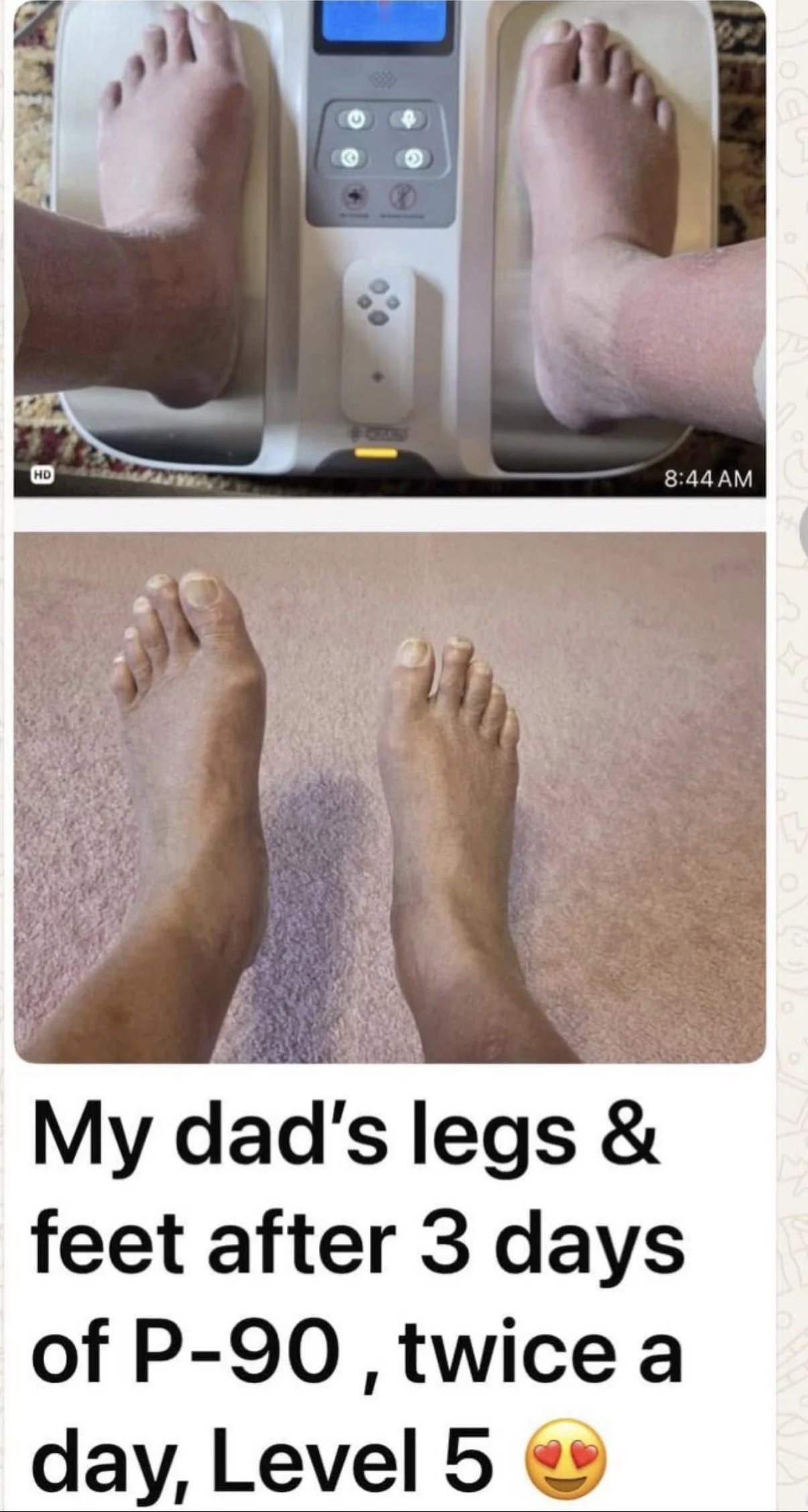 Top image shows a person's feet and bottom image shows a pair of feet with healthy skin.