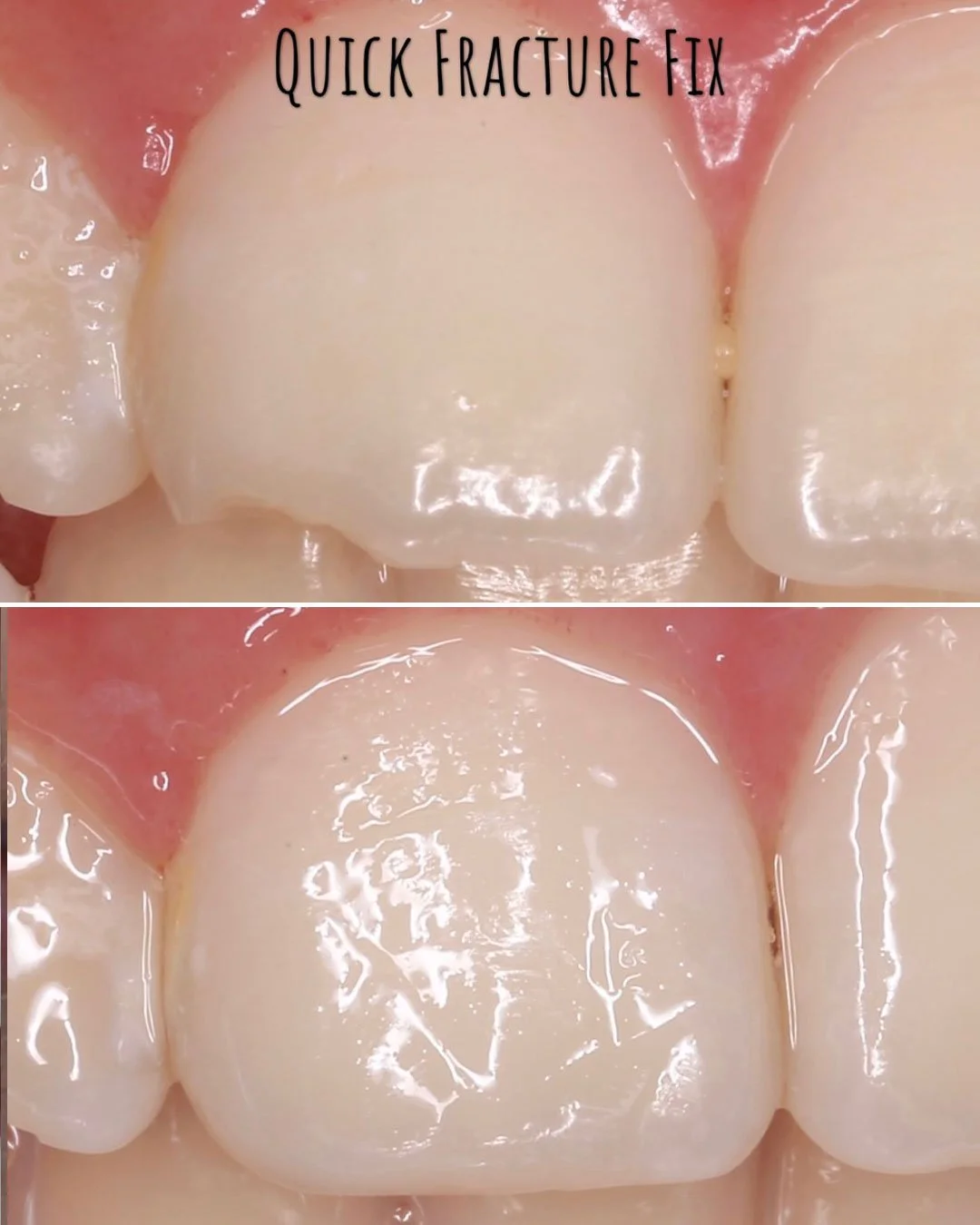 Fracture Fix