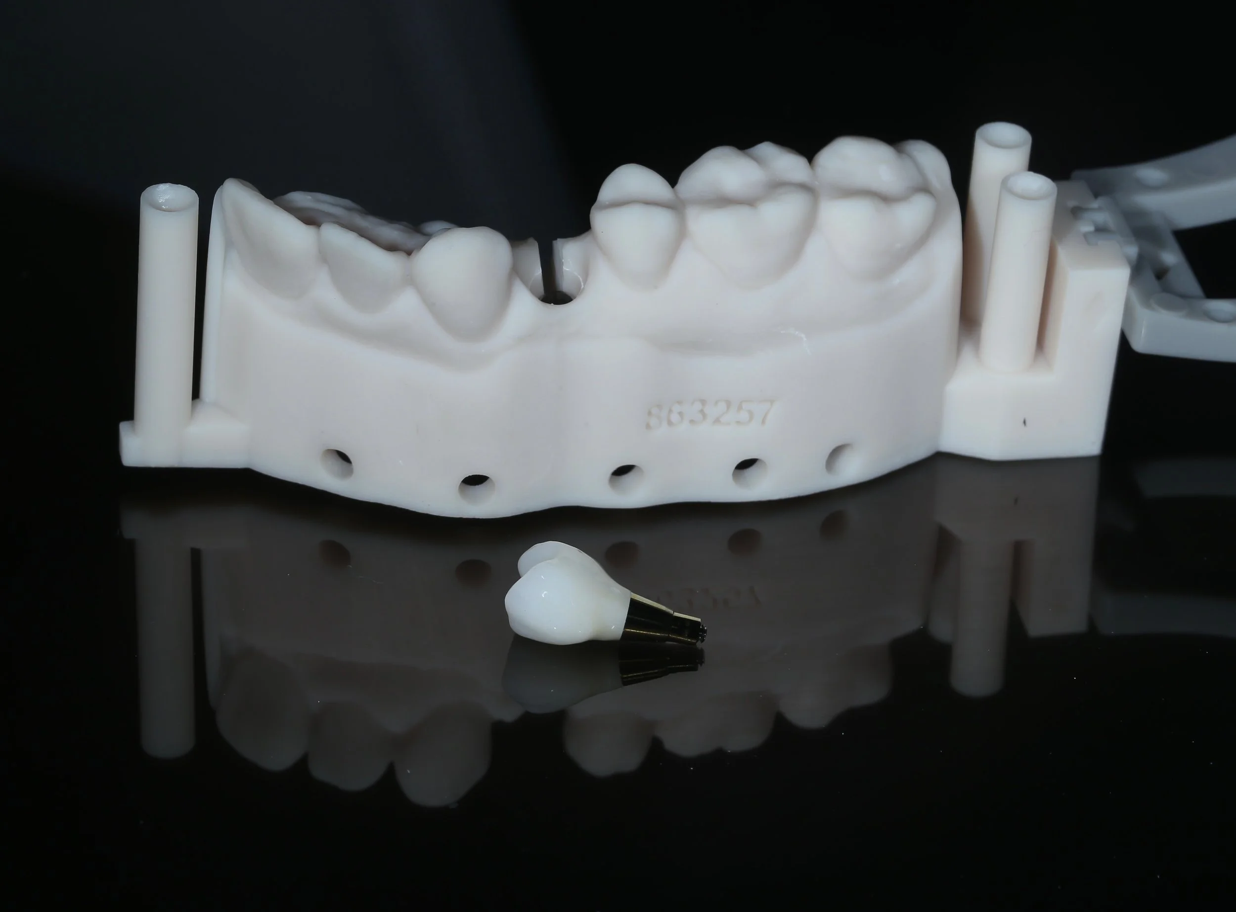 Dental Implants