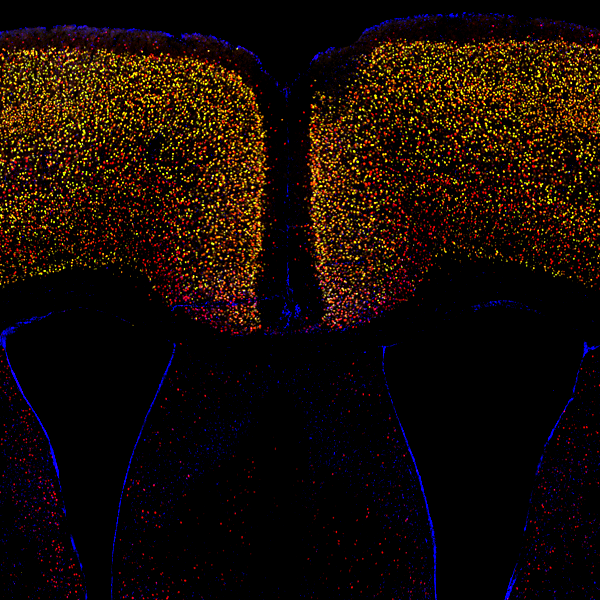 MAPPING THE BRAIN’S RESPONSE TO OPIOIDS