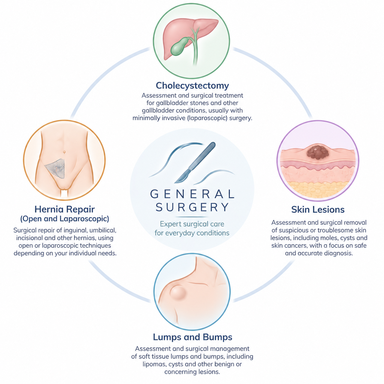 Diagram of general surgery services including cholecystectomy, hernia repair, skin lesions, lumps and bumps, with illustrations and descriptions for each type of procedure.