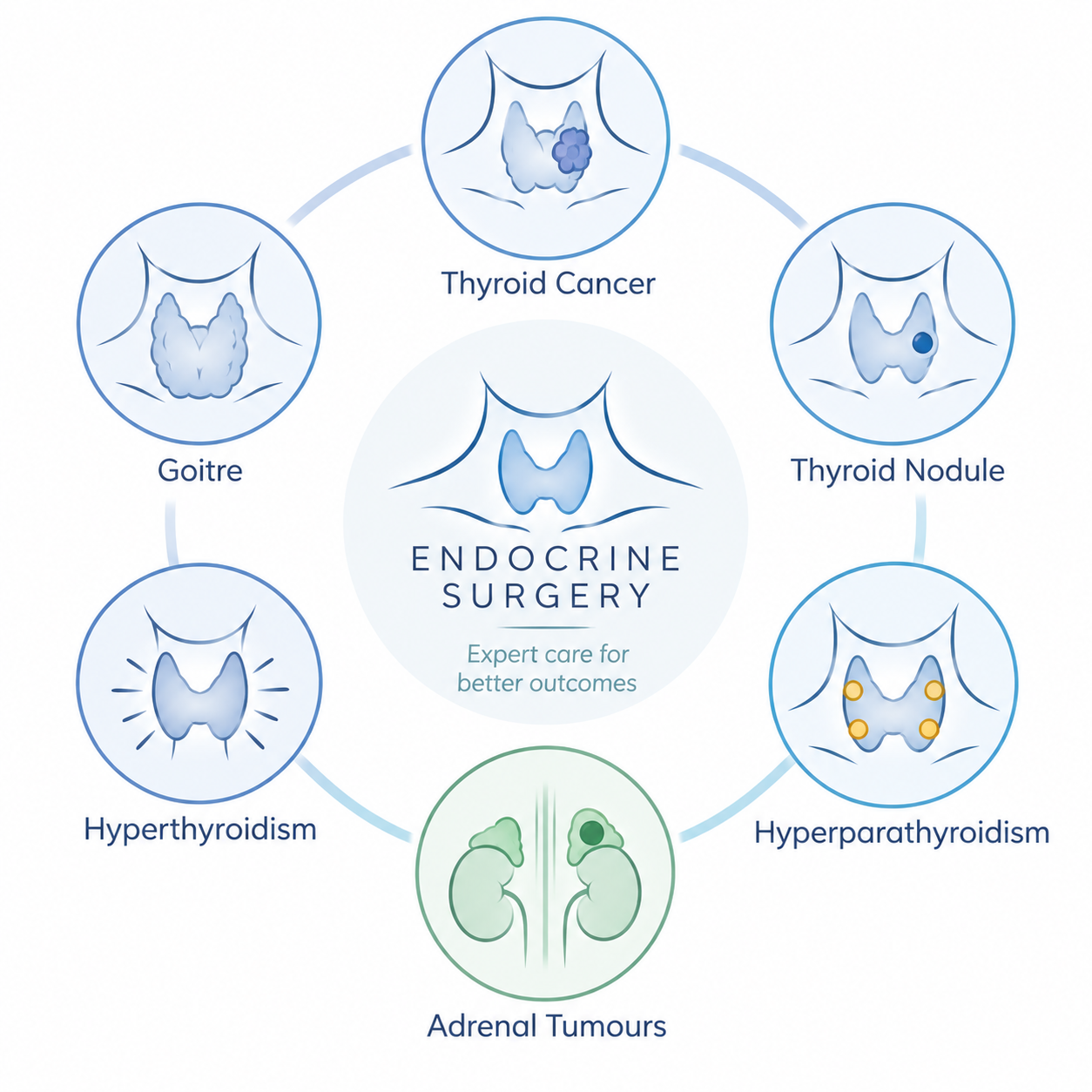 Diagram showing various thyroid-related conditions and endocrine surgery options, including goiter, thyroid cancer, thyroid nodule, hyperthyroidism, hyperparathyroidism, adrenal tumors, with a central focus on endocrine surgery.