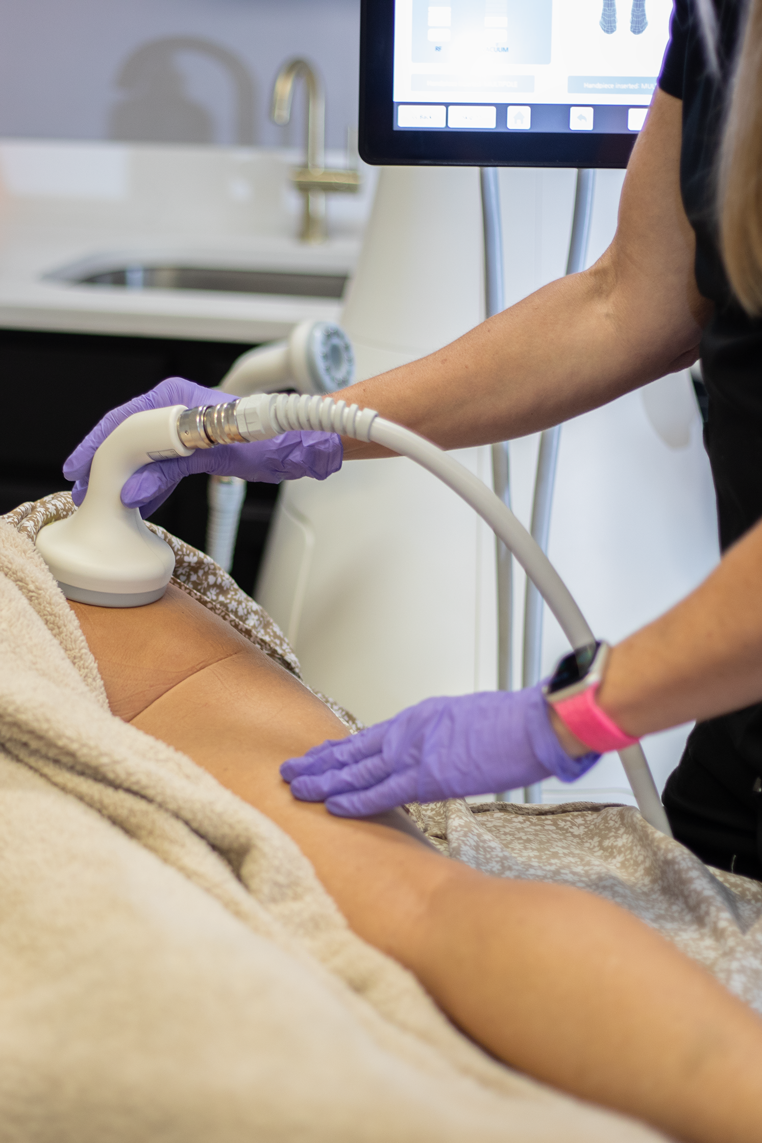 Cellulite Treatment Series at Rejuvenate Wellness in Florence, KY