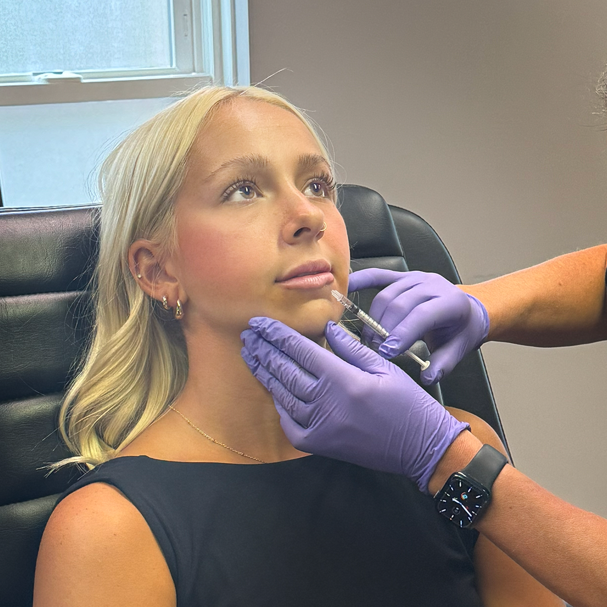 Lip Filler at Rejuvenate Wellness in Florence, KY