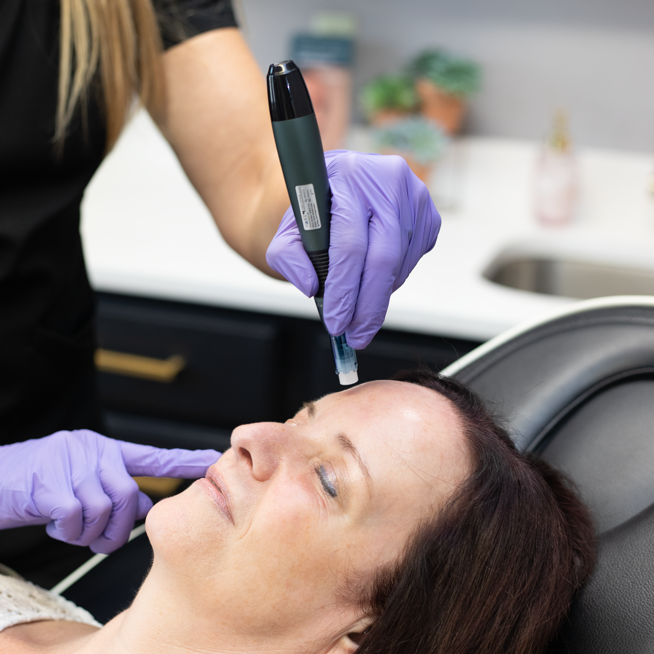 Microneedling at rejuvenate wellness in Florence KY