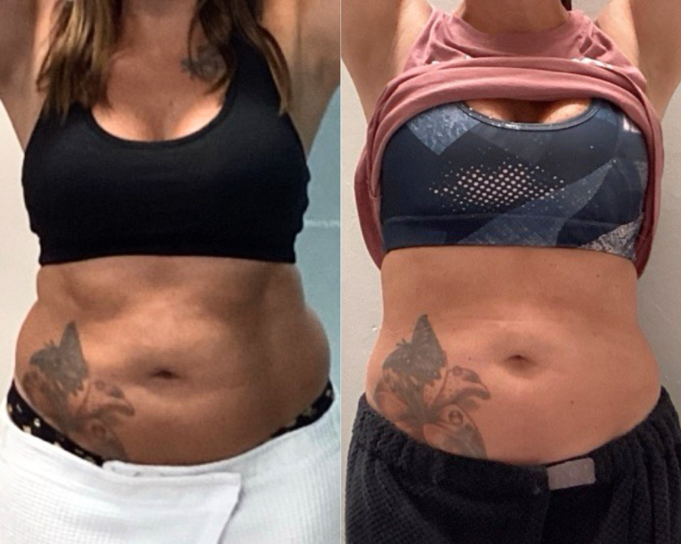 Rejuvenate Wellness in Florence, KY - T Shape 2 Body Contouring