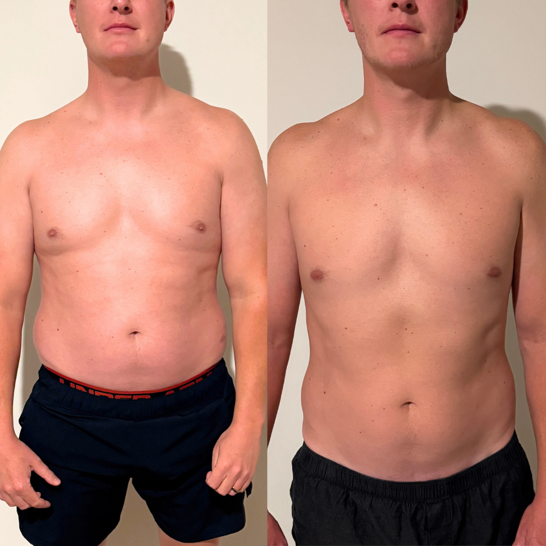 Onyx Aesthetics Before & Afters (4) (1).png