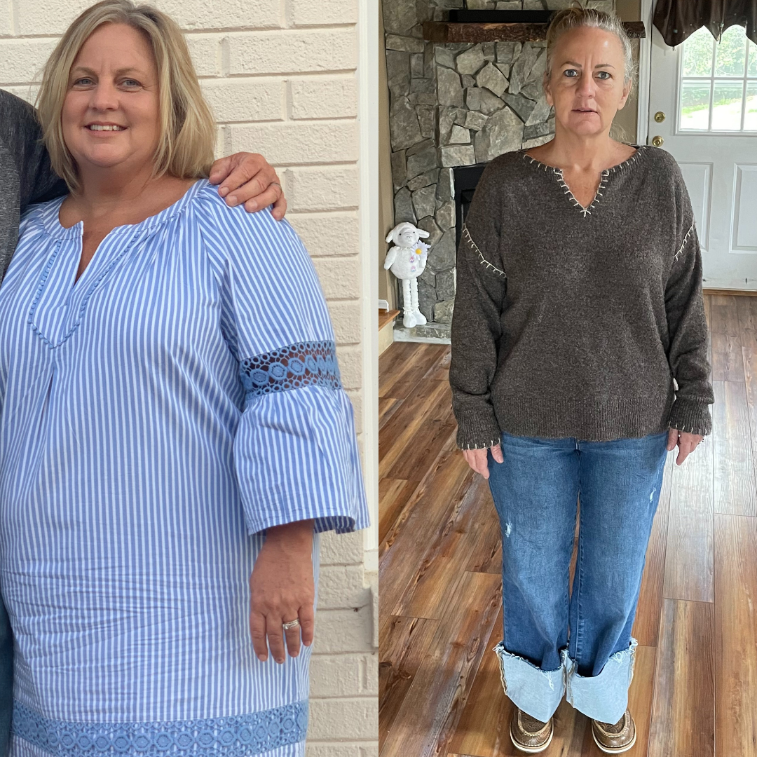 Side-by-side comparison photo of a woman before and after a weight loss journey, dressed in casual clothing, standing indoors in different settings.