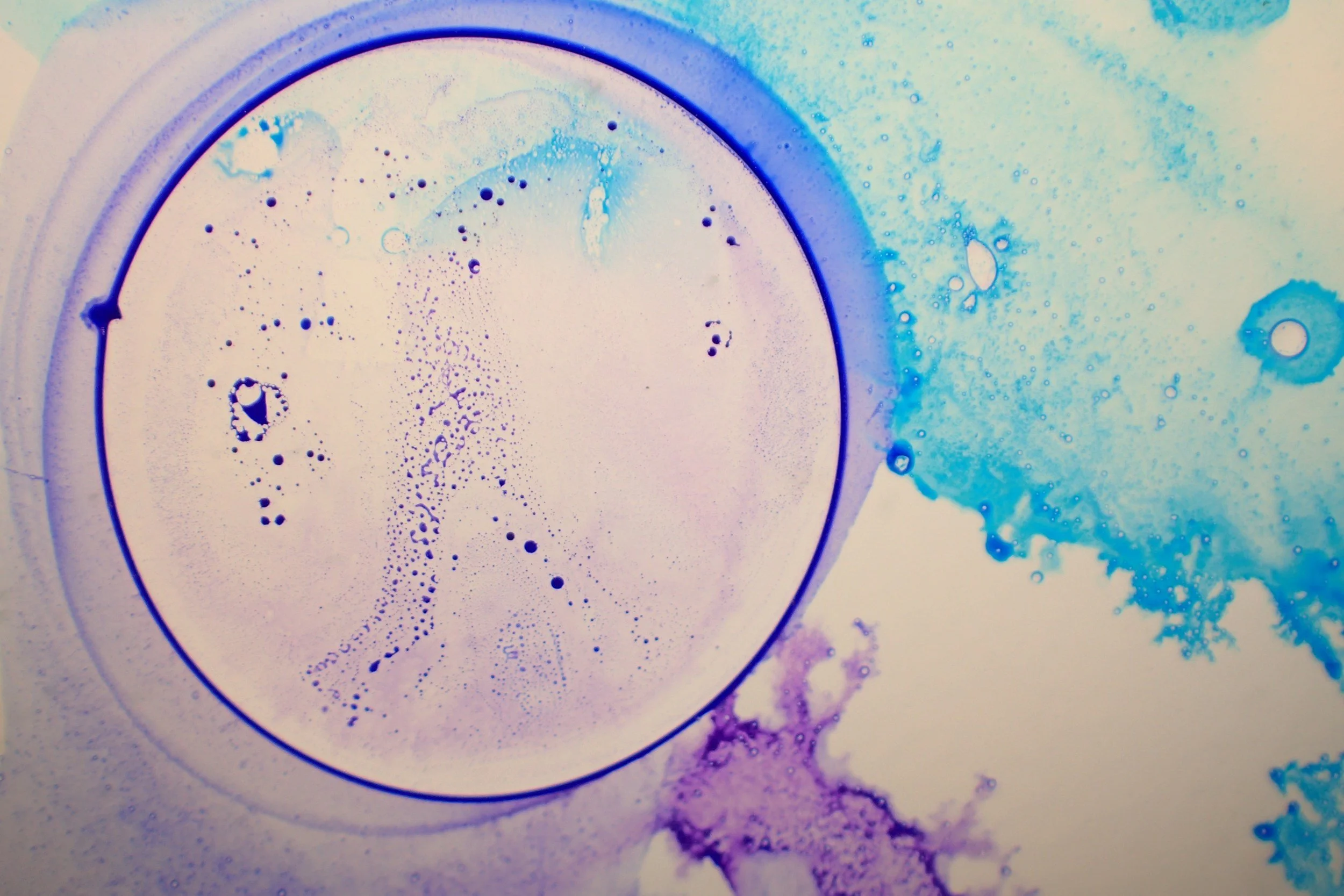 Giddy — When Donating Your Embryos Is Not An Easy Decision