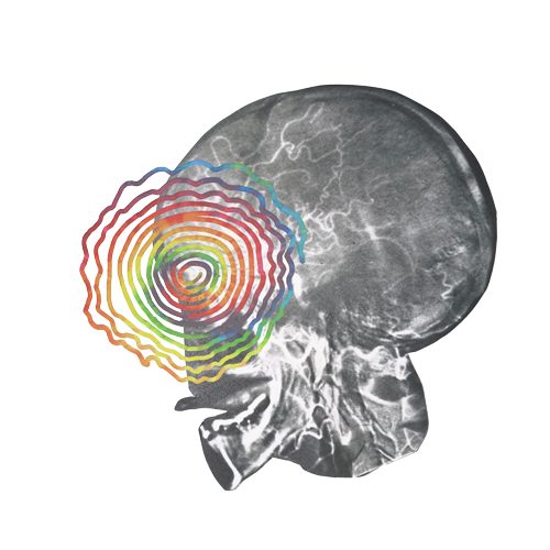 photo collage of xray of skull illustrating an imaginative depiction of an LSD trip