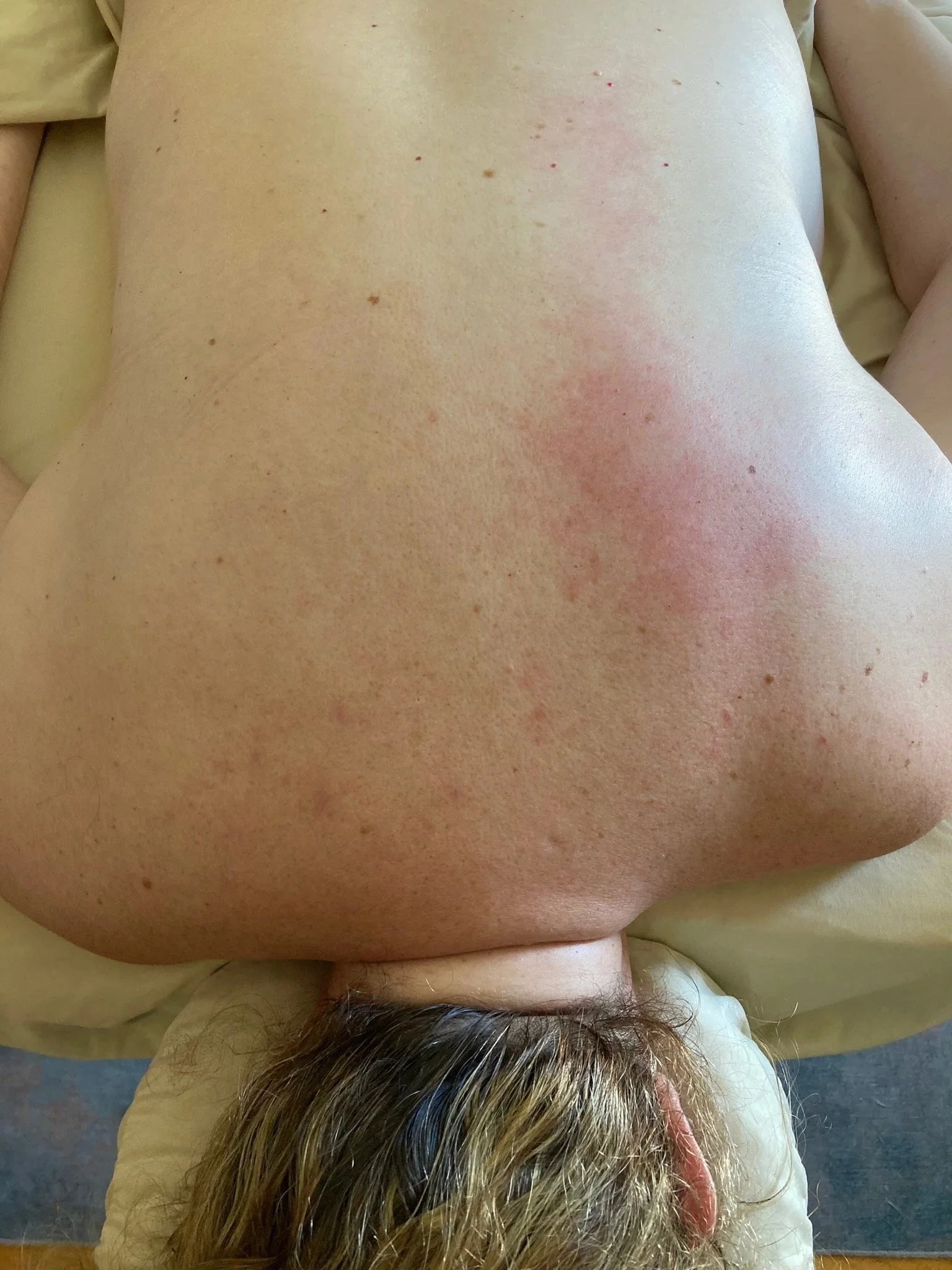 Top-down view of a person lying face down on a massage table, showing their back with a before and after of myofascial release bodywork