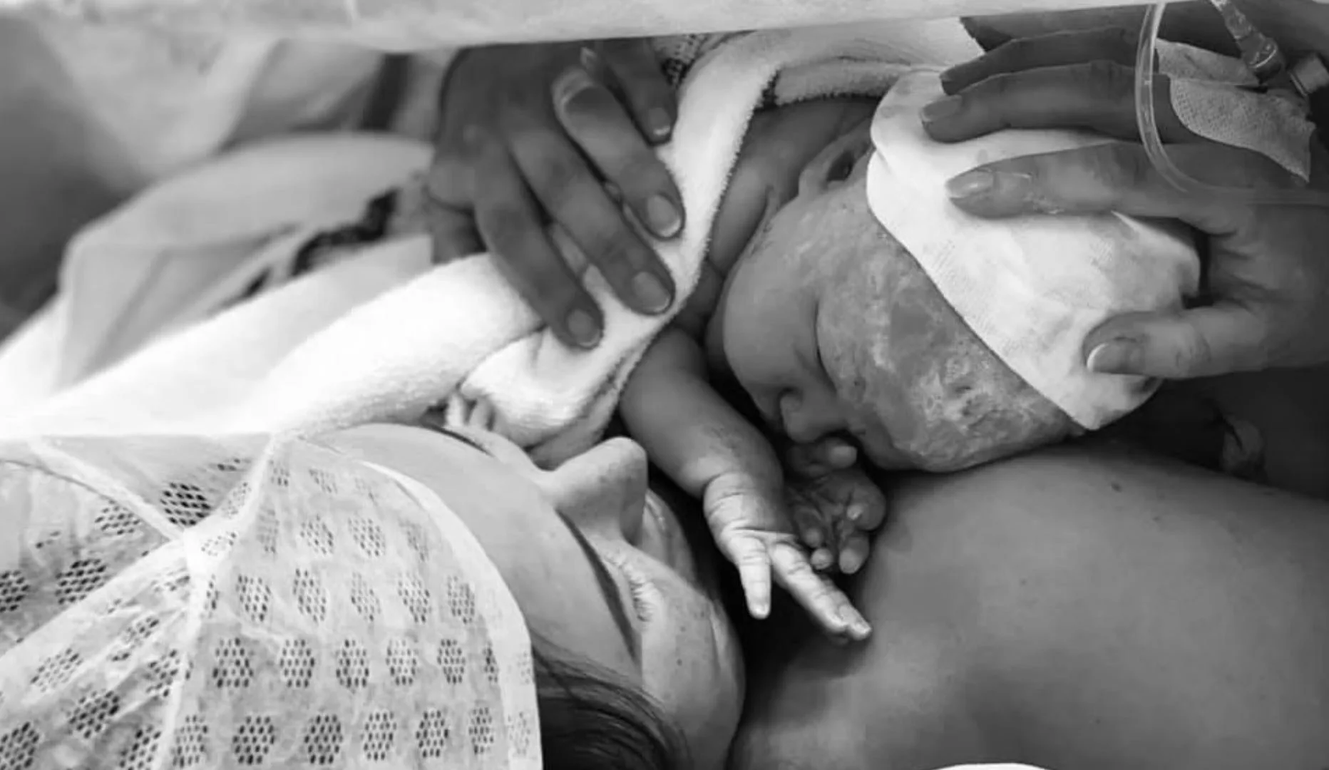 A newborn baby being delivered with medical professionals assisting. The baby is still connected to the mother via the umbilical cord, and the scene shows hands carefully supporting the baby's head and body.