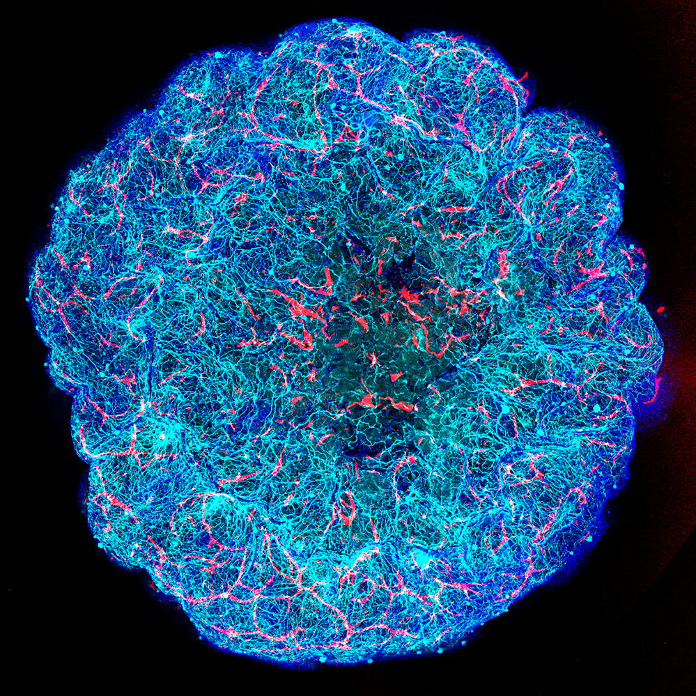 A neon-colored, detailed image of a human brain, highlighting the brain's blood vessels in bright red and blue against a black background.