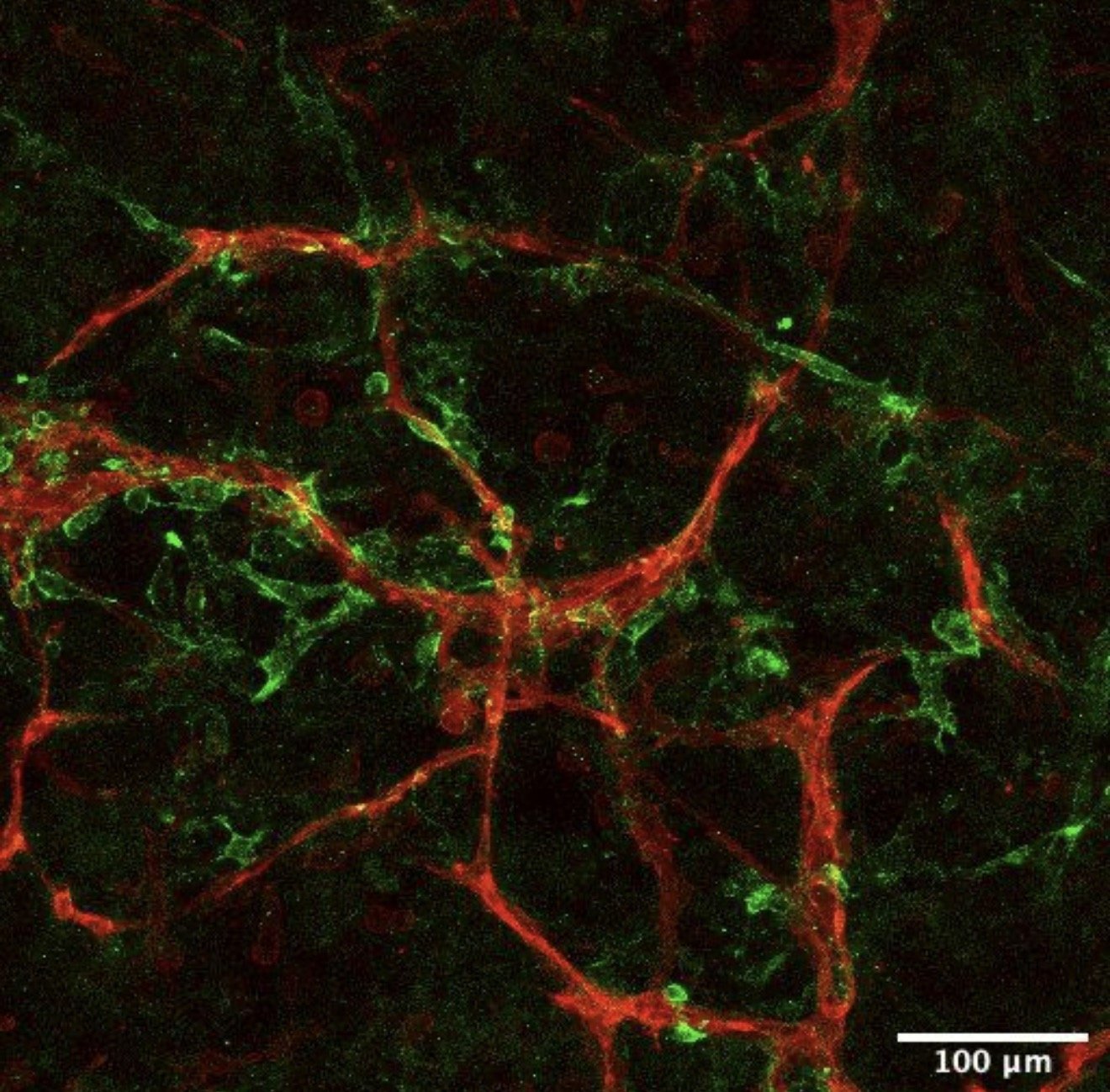 Close up image of an miBRAIN cell at 100um. Endothelial cell vasculature and pericytes in a miBrain aged for 3 weeks in culture.