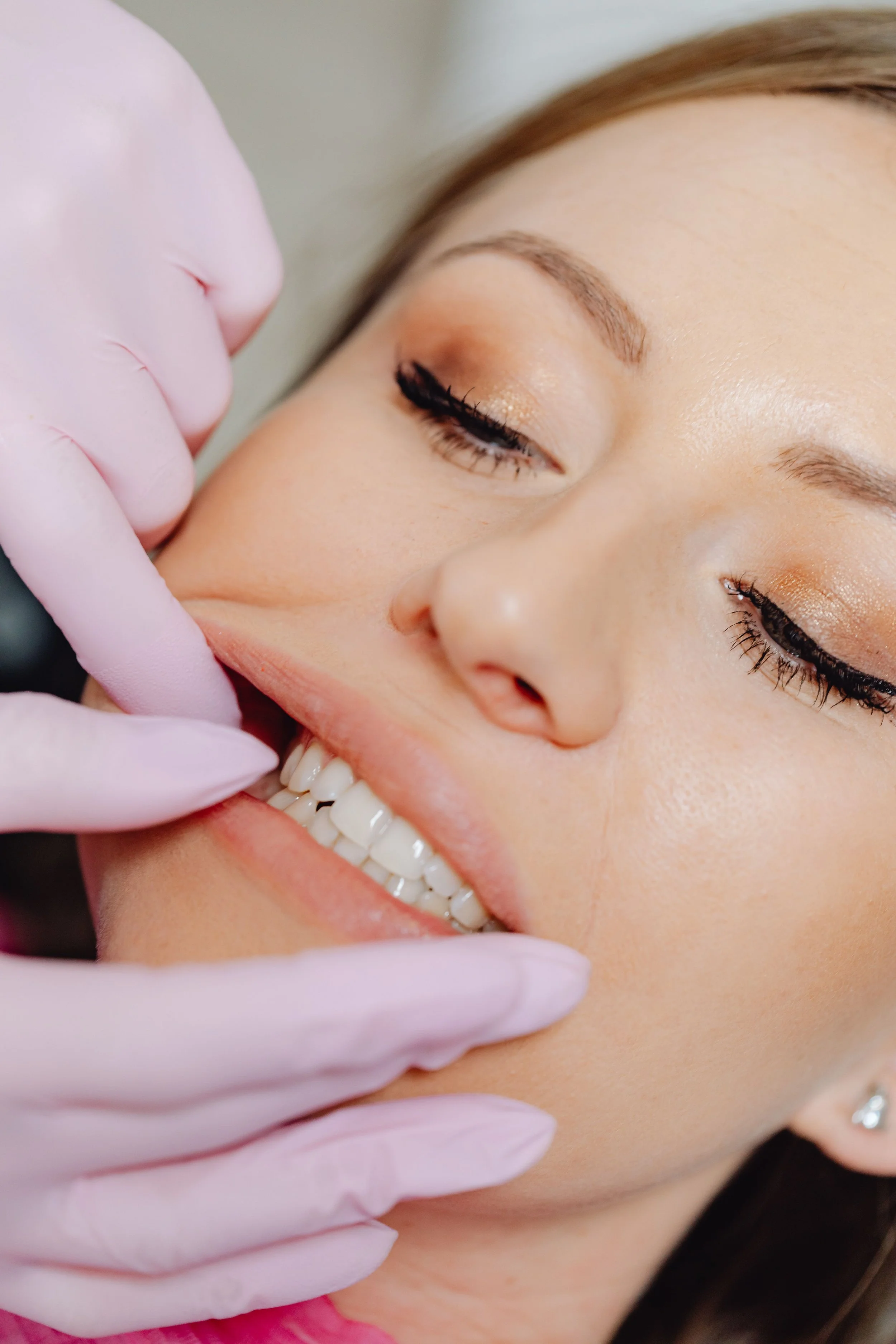 Tooth whitening Texarkana, Texas