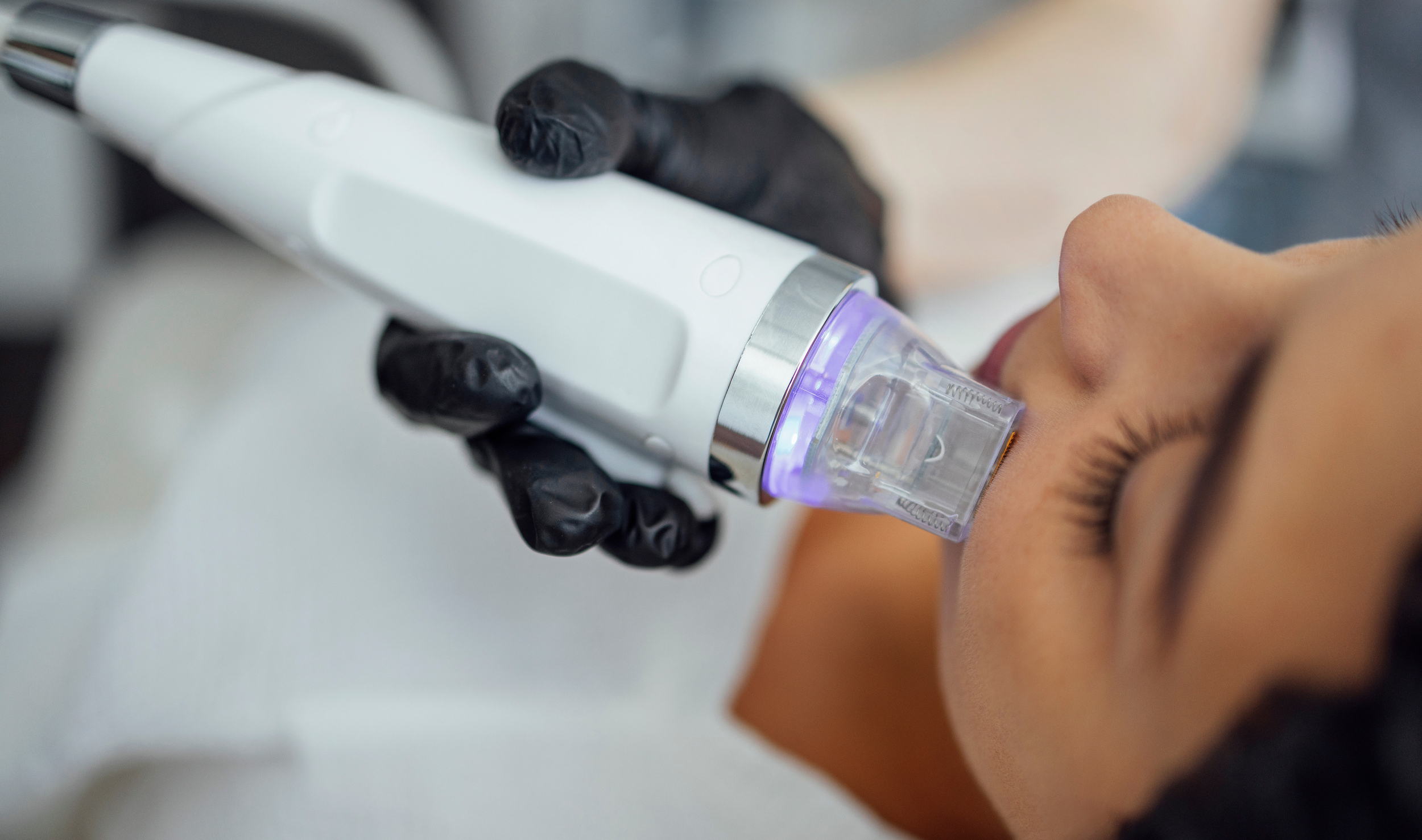 A close-up of a person receiving a cosmetic or medical treatment with a specialized device applying a purple light to their face, while wearing a protective transparent mask on the face.