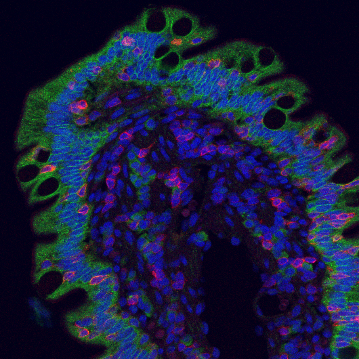 A microscopic image of a biological tissue sample with fluorescent staining showing cell nuclei in blue, other cellular structures in red and green, and a dark background.