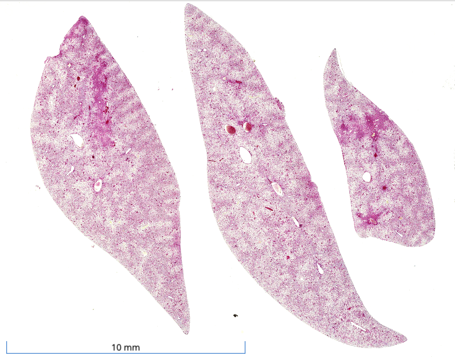 Microscope connected to a computer monitor displaying a microscopic view of purple and pink cells.