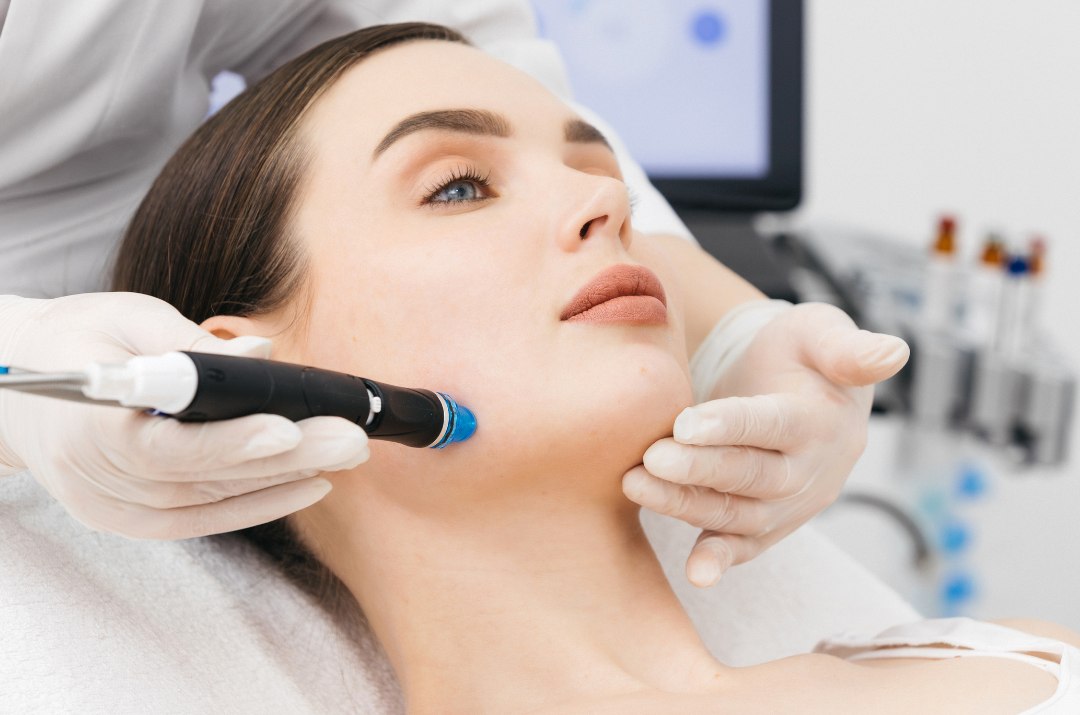 Medspa in  Alliance, OH, 44601  Microneedling Near Me