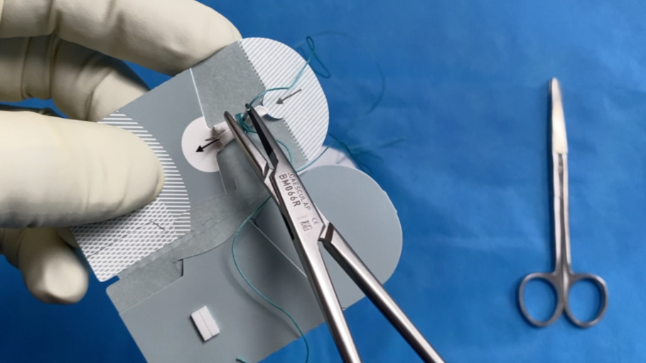Close-up of a person using surgical forceps to handle a small medical device, with a pair of scissors placed on a blue surgical drape in the background.