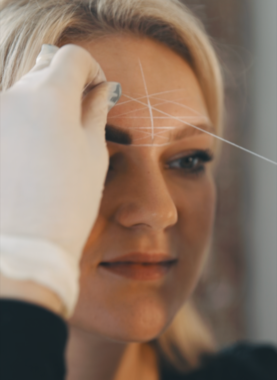 Eine Frau beim kosmetischen Eingriff, auf der Stirn sind markings und Linien für die Behandlung sichtbar.