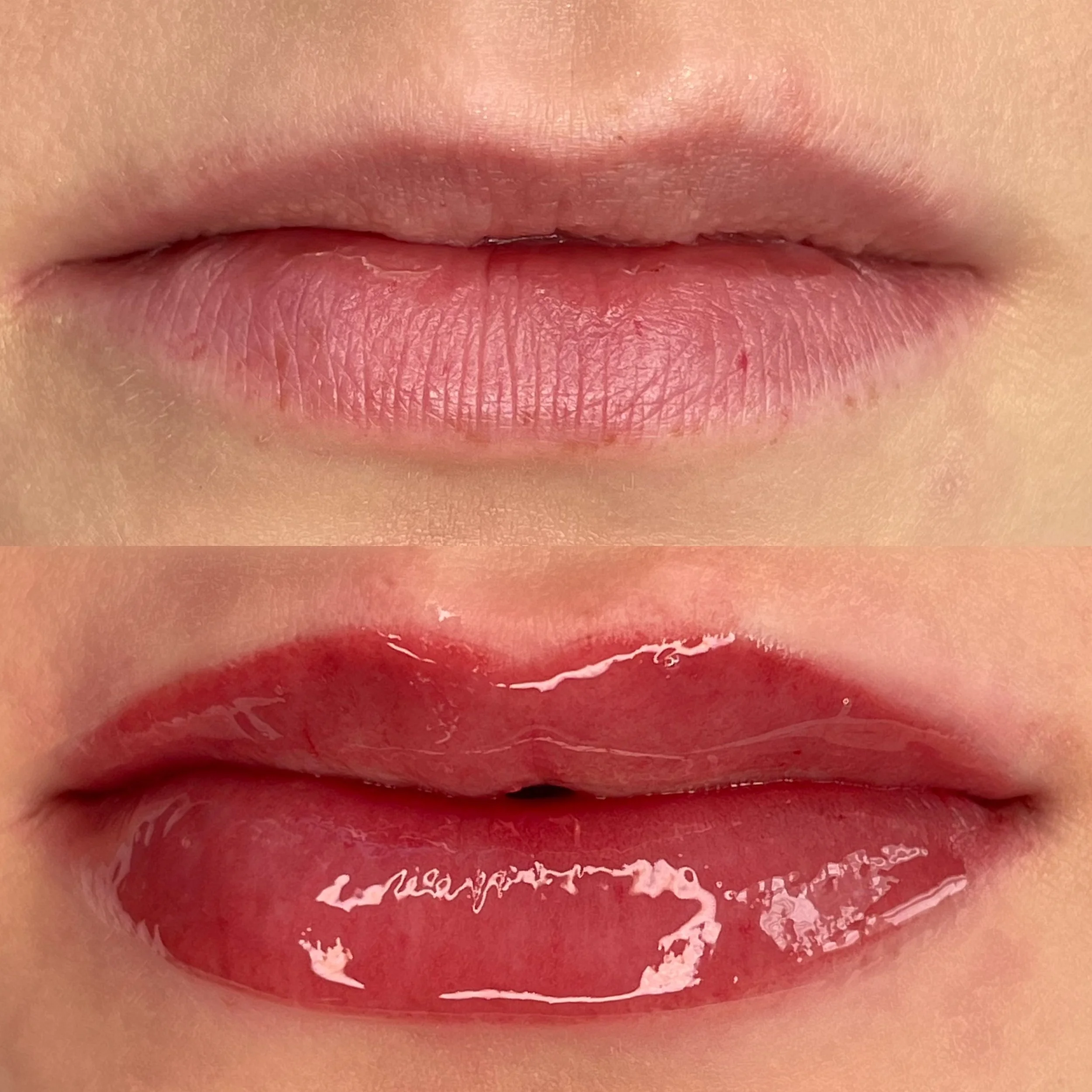 Lippenpigmentierung