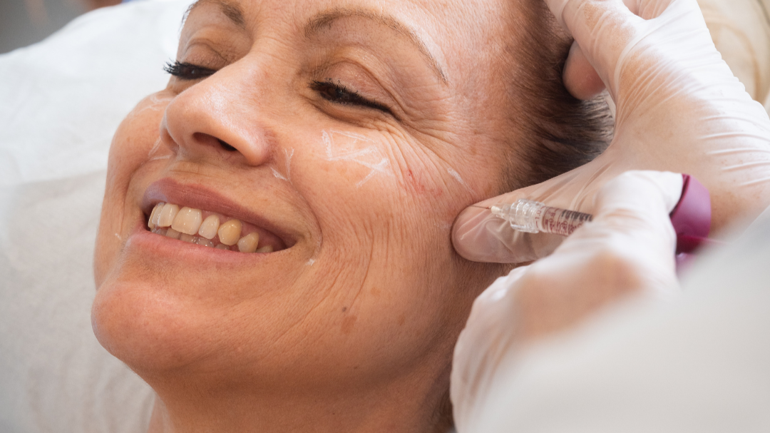 ¿A qué edad debería empezar con la medicina estética?