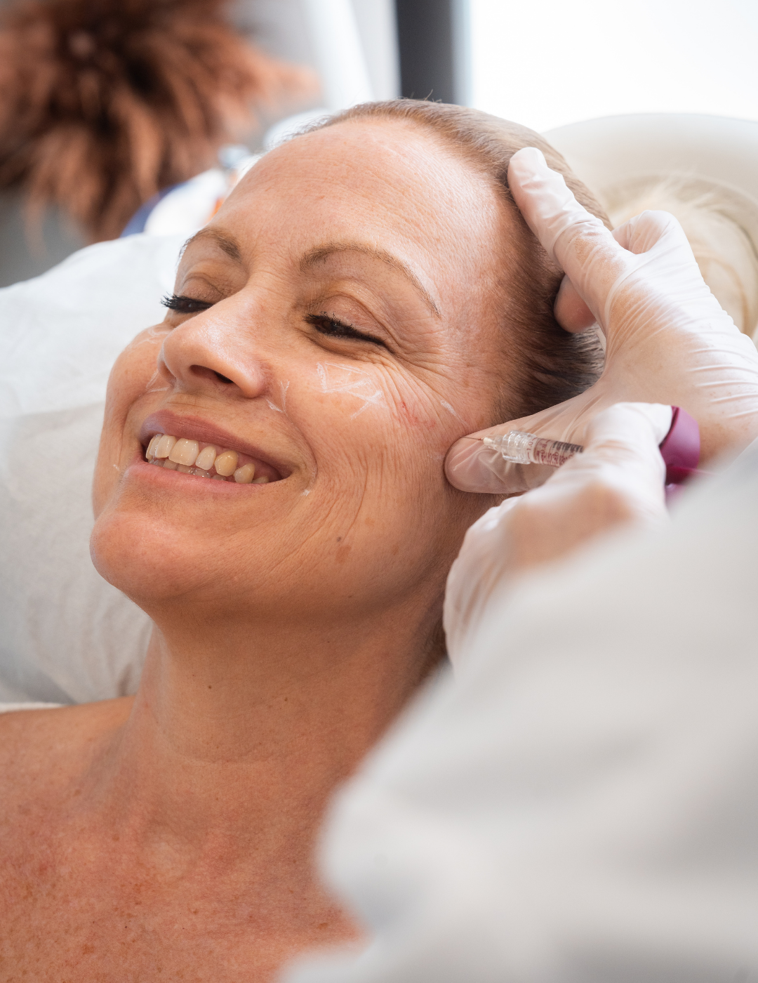 Rejuvenecimiento facial