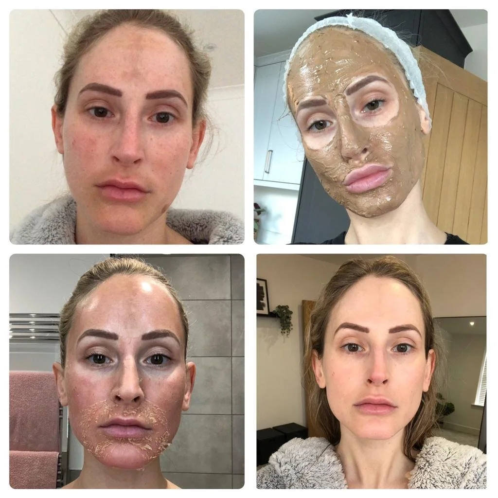 COSMELAN PIGMENTATION TREATMENT