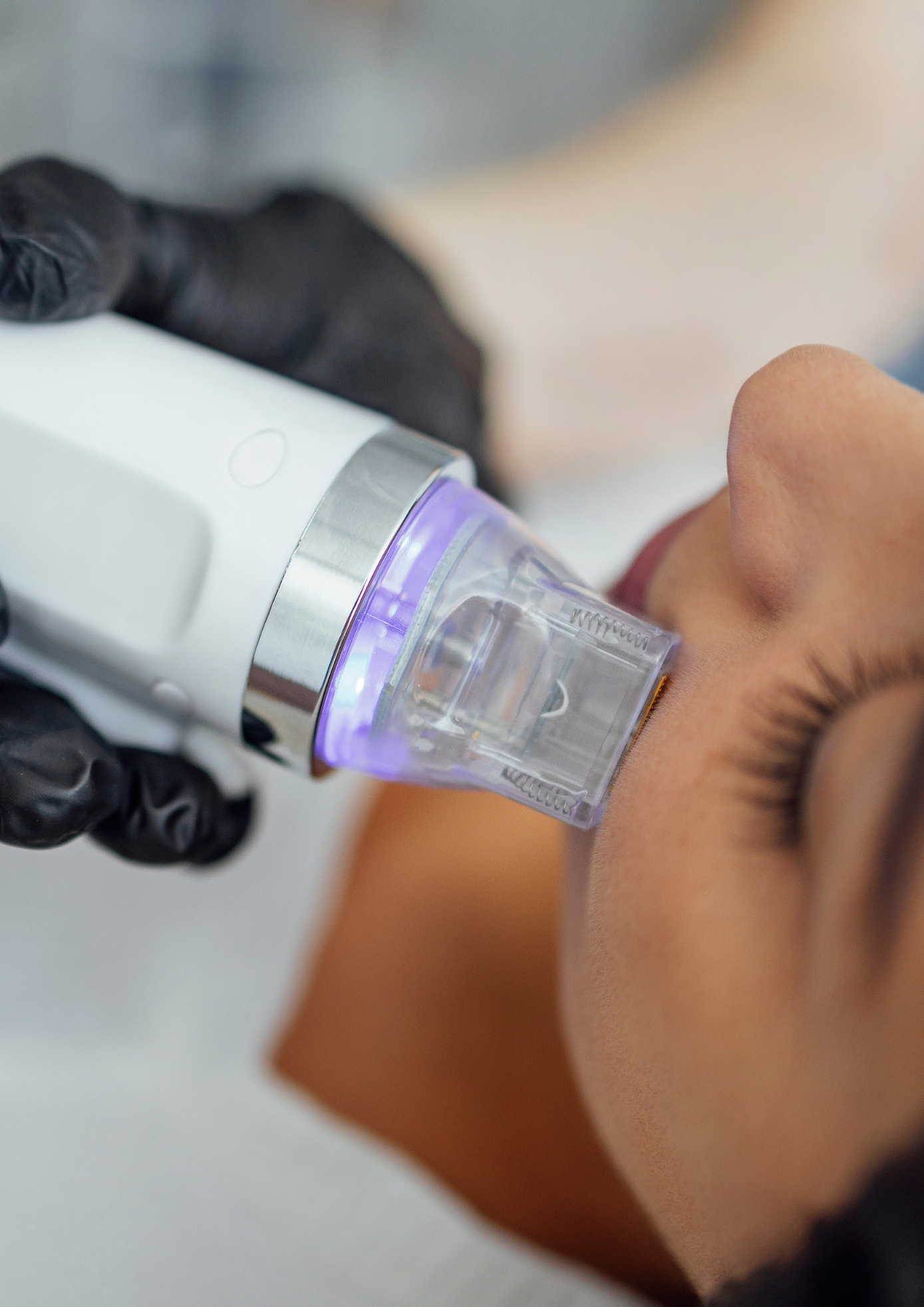 Exosome Therapy in Essex