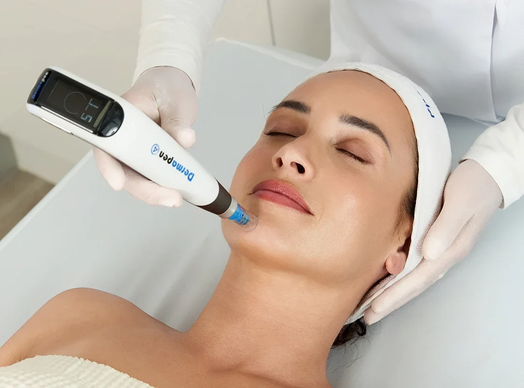 The Benefits of Microneedling: Your Path to Great Skin in Chelmsford