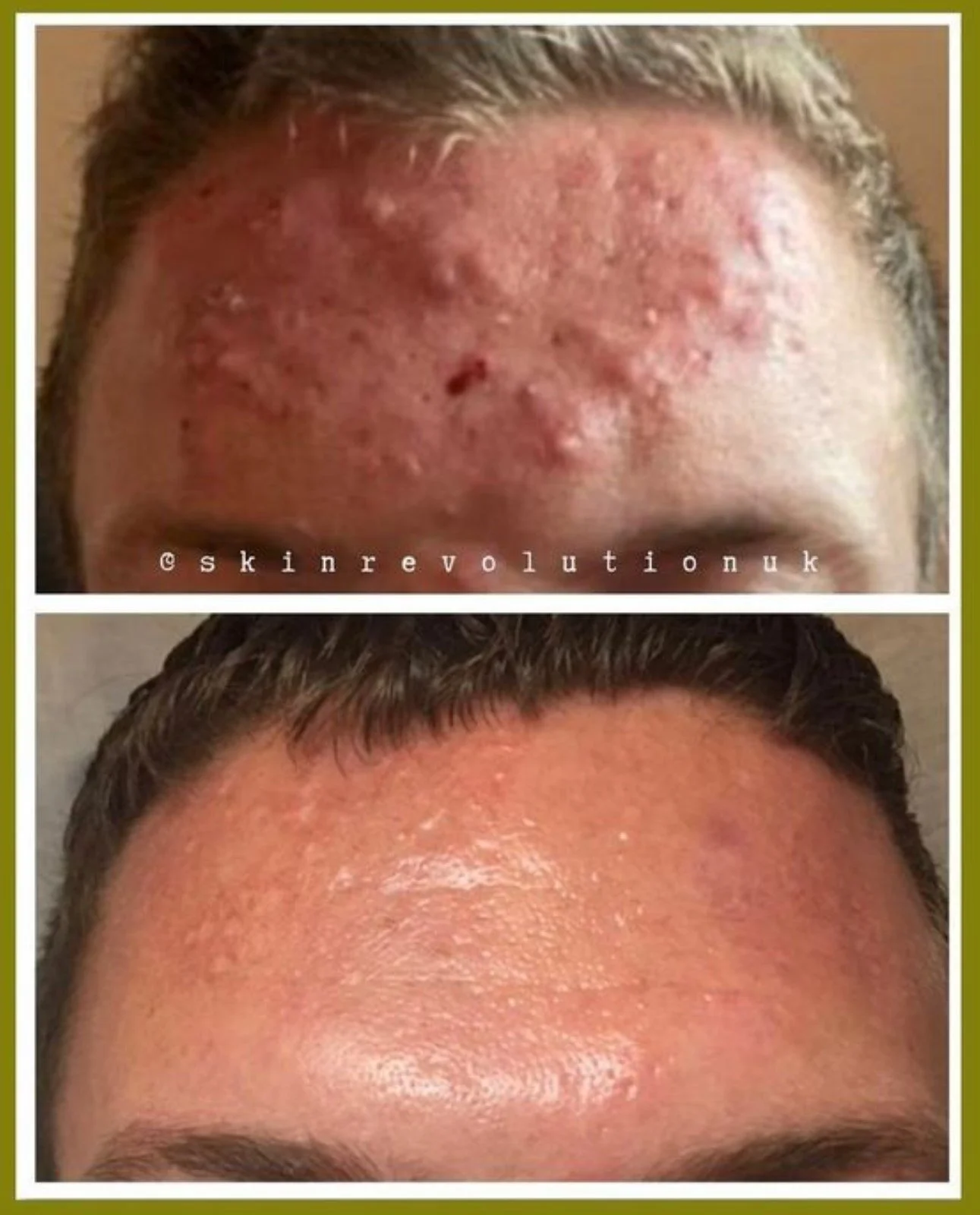 dedicated skin clinic in Essex
