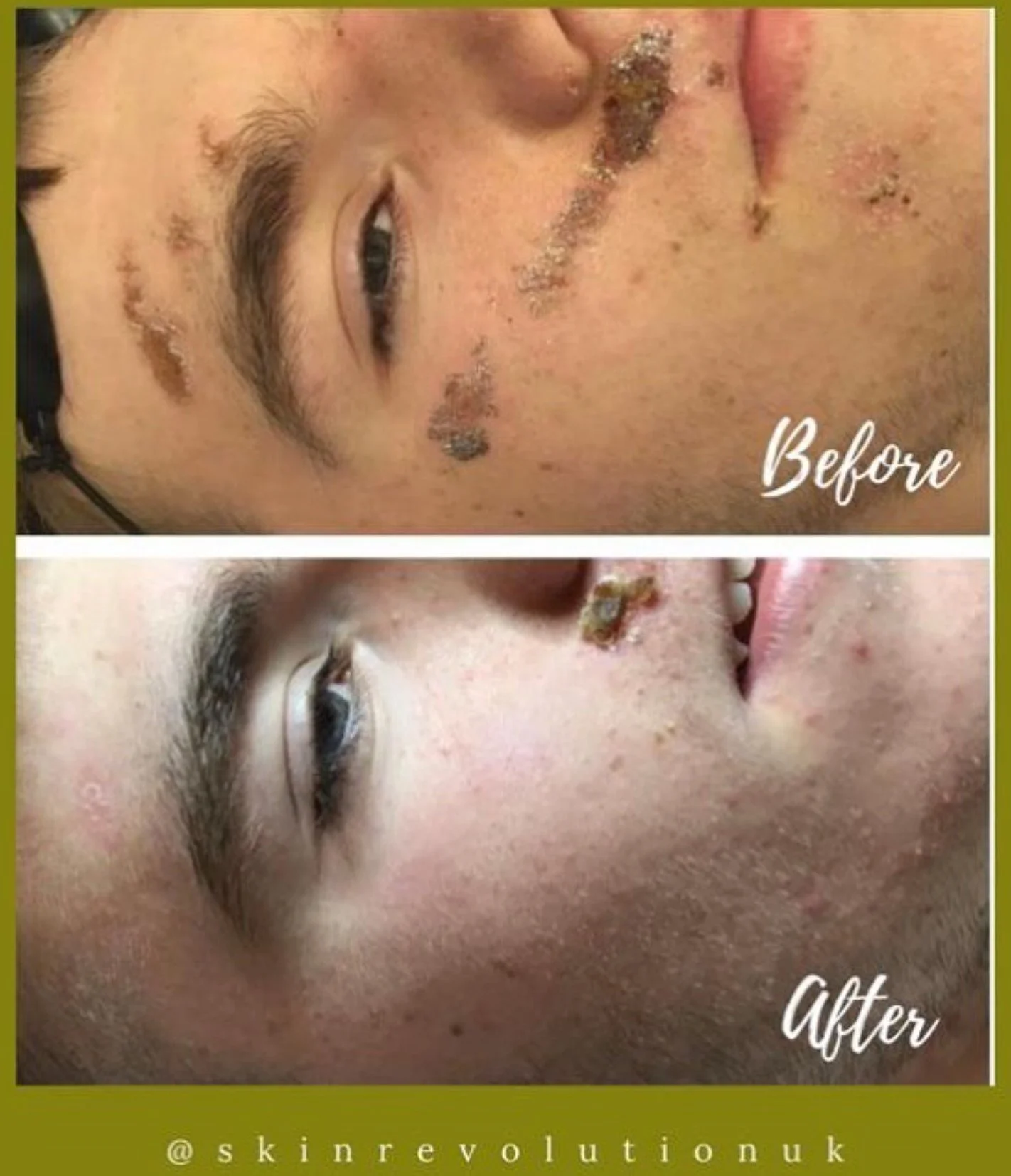 dedicated skin clinic in Essex