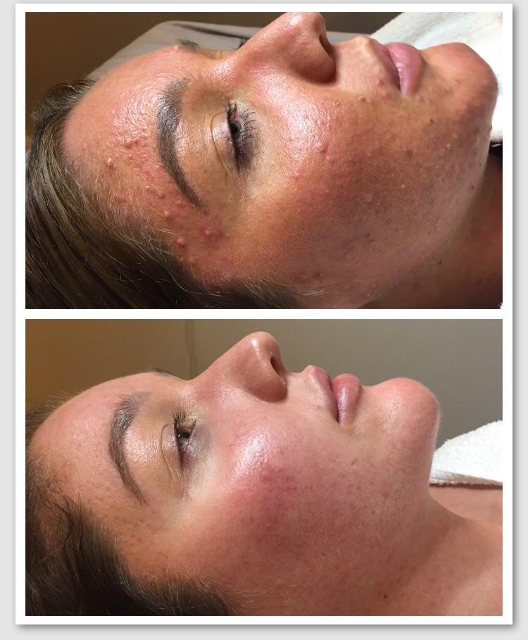 DMK Client Story
