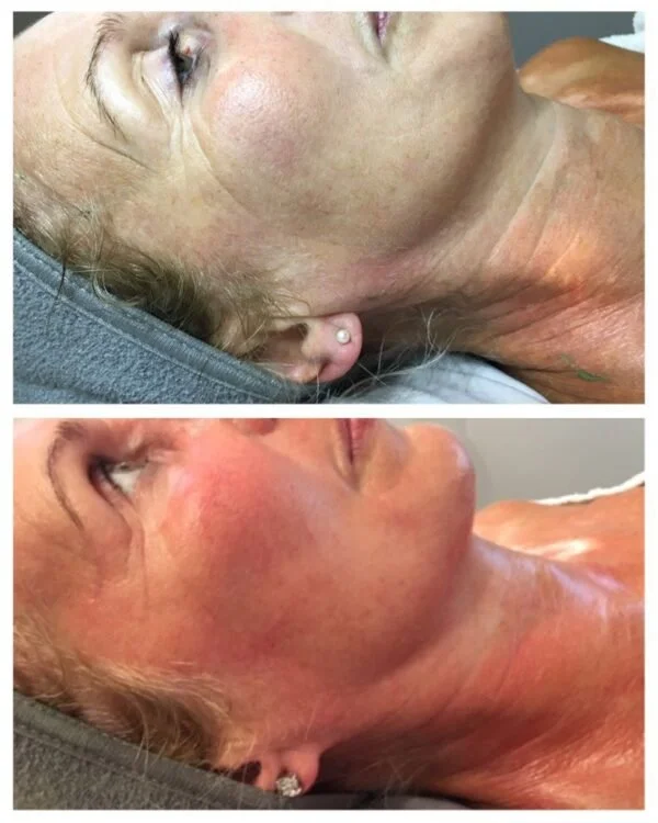 Chelmsford Skin Treatments