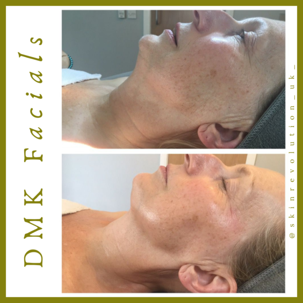Chelmsford Skin Treatments