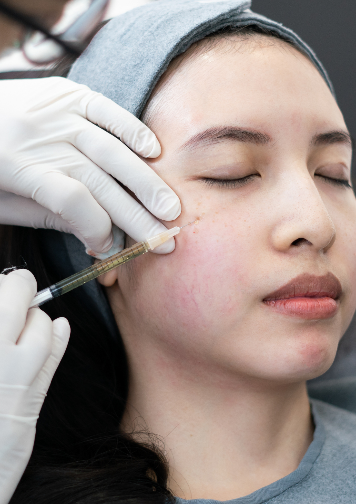 Close-up of a woman receiving a facial injection procedure.