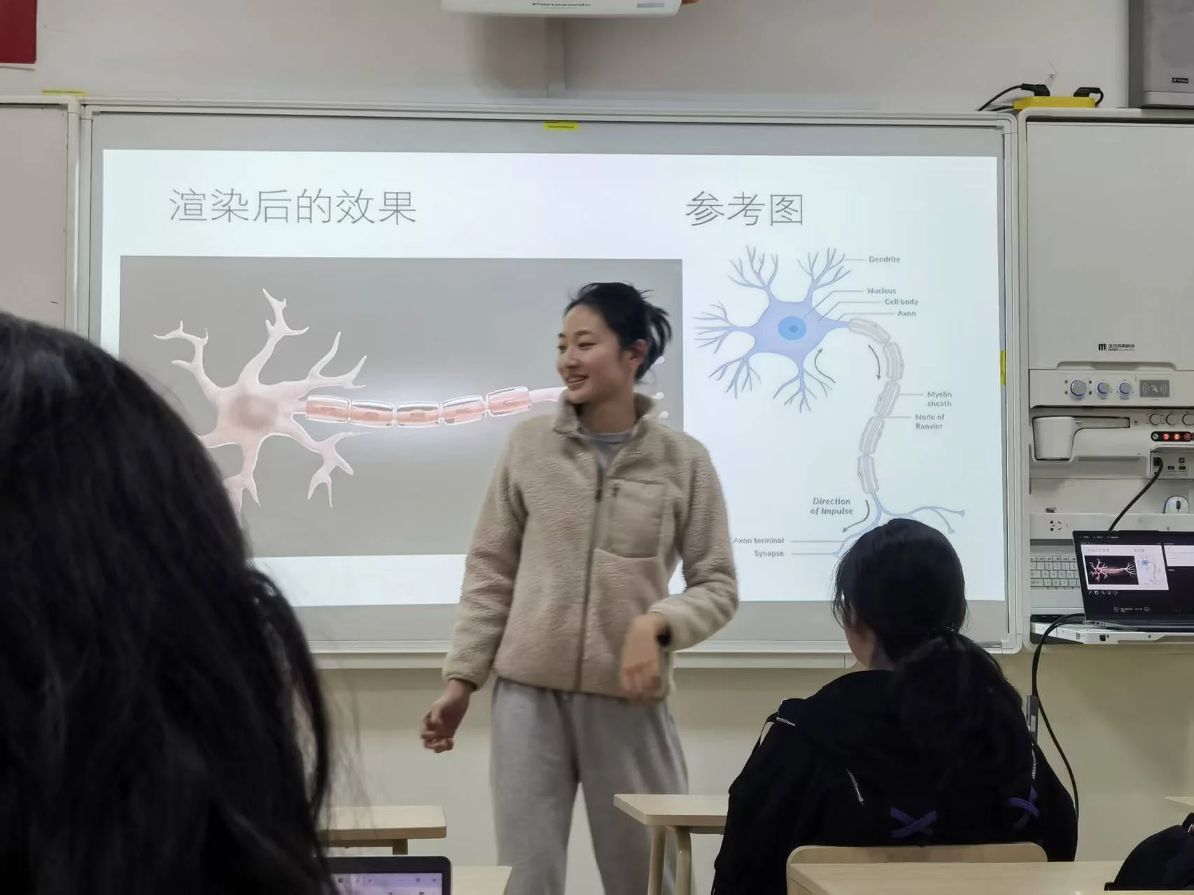 Circle of Willis