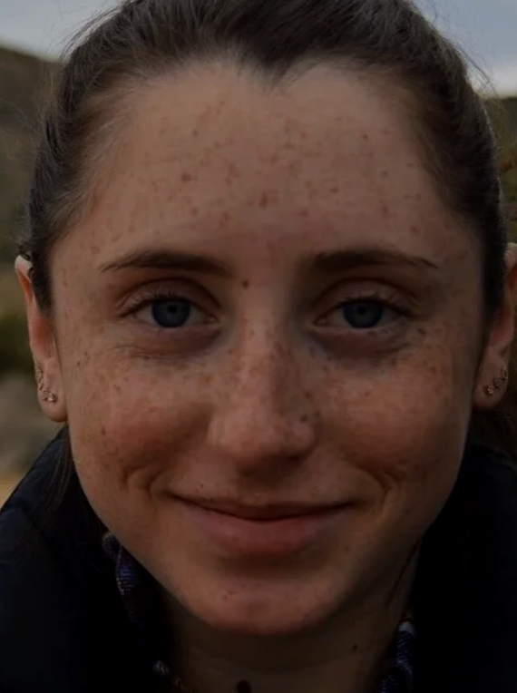 Close-up of a young woman with freckles and blue eyes smiling outdoors.