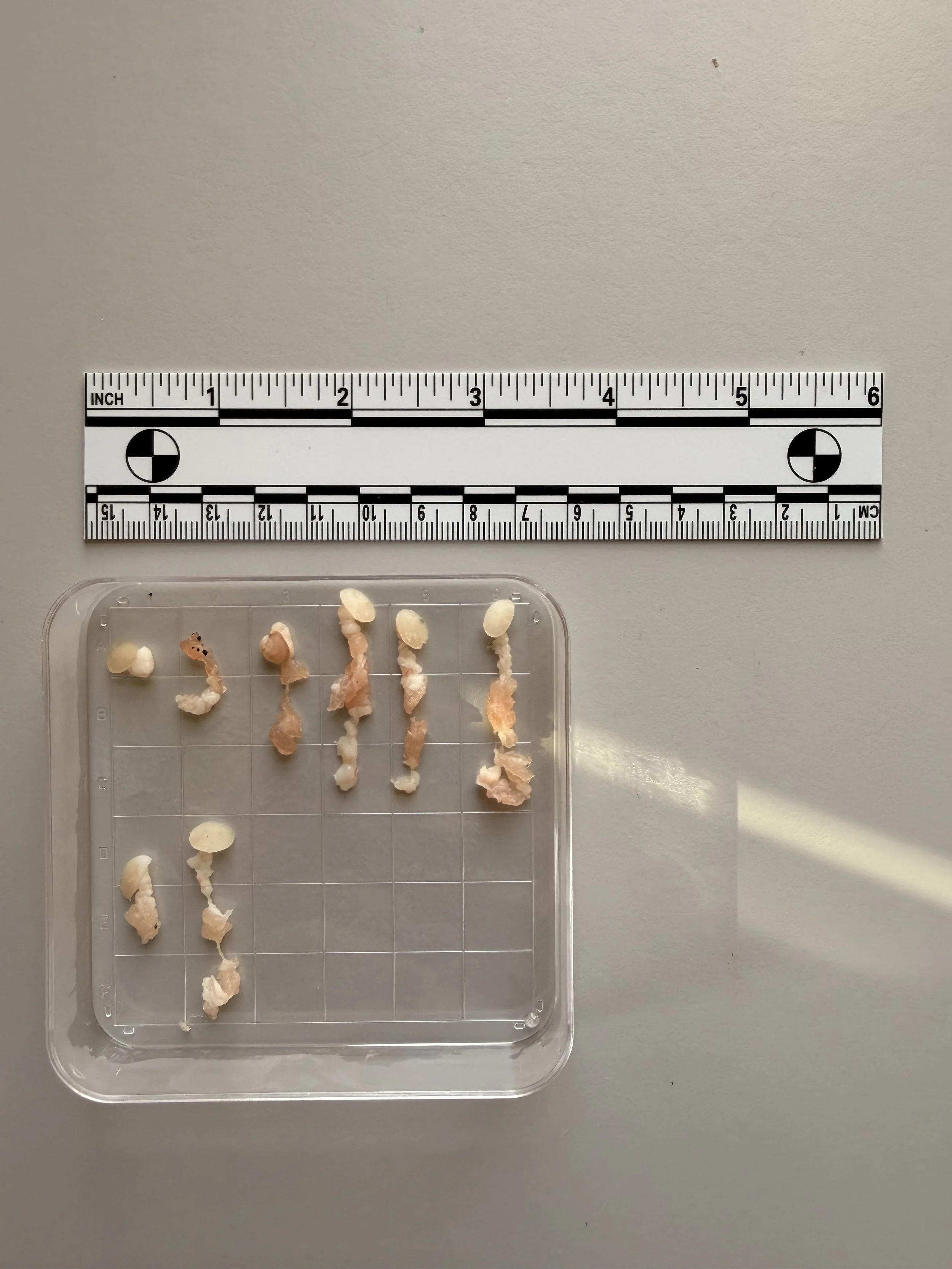 A clear plastic container with small, irregularly shaped, light-colored objects, possibly shells or stones, placed on a gray surface.