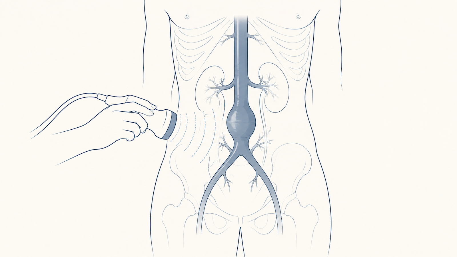 AAA Screening: Benefits, Risks and What the Evidence Shows