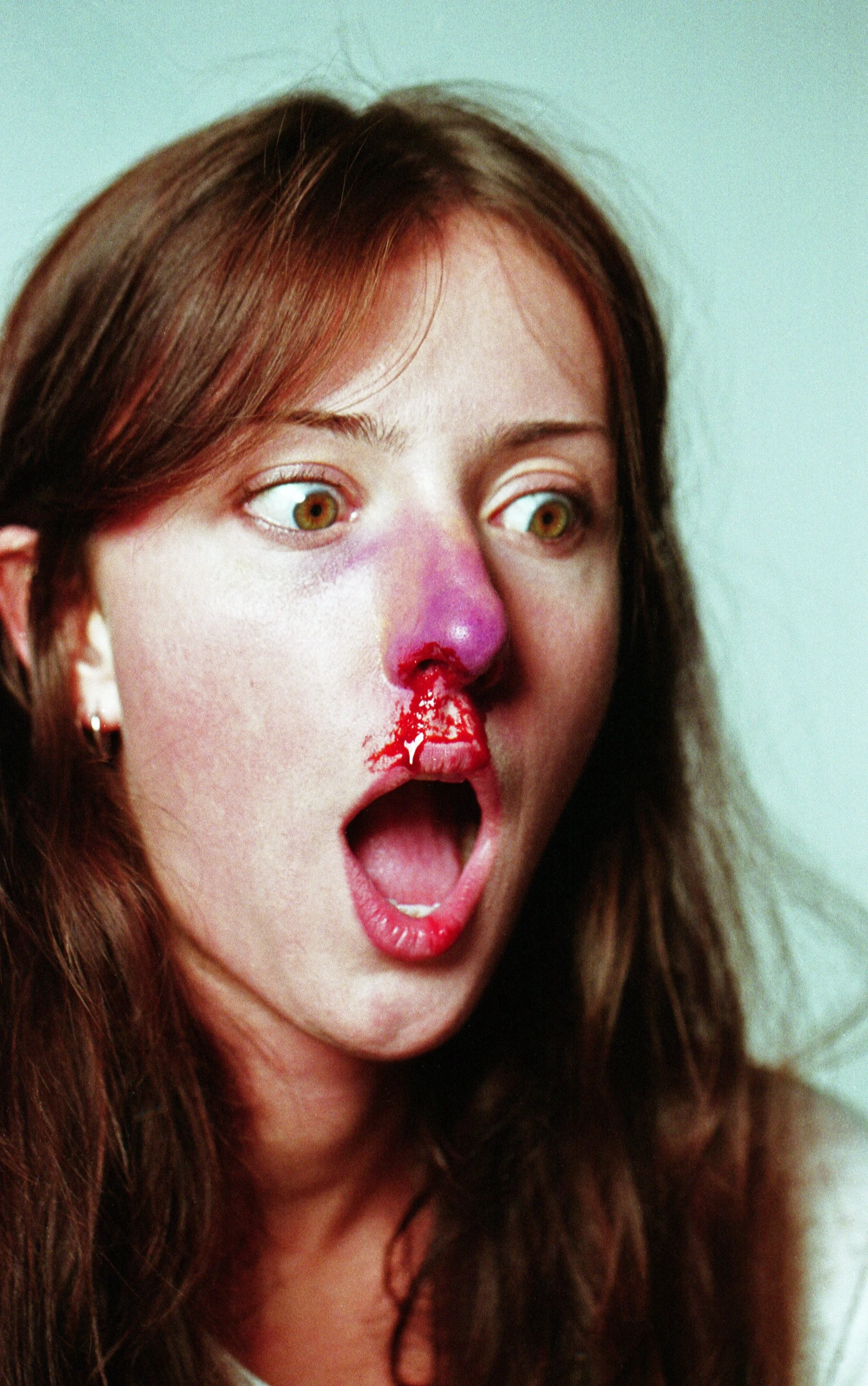 brokennose_ameilia_01 copy.JPG