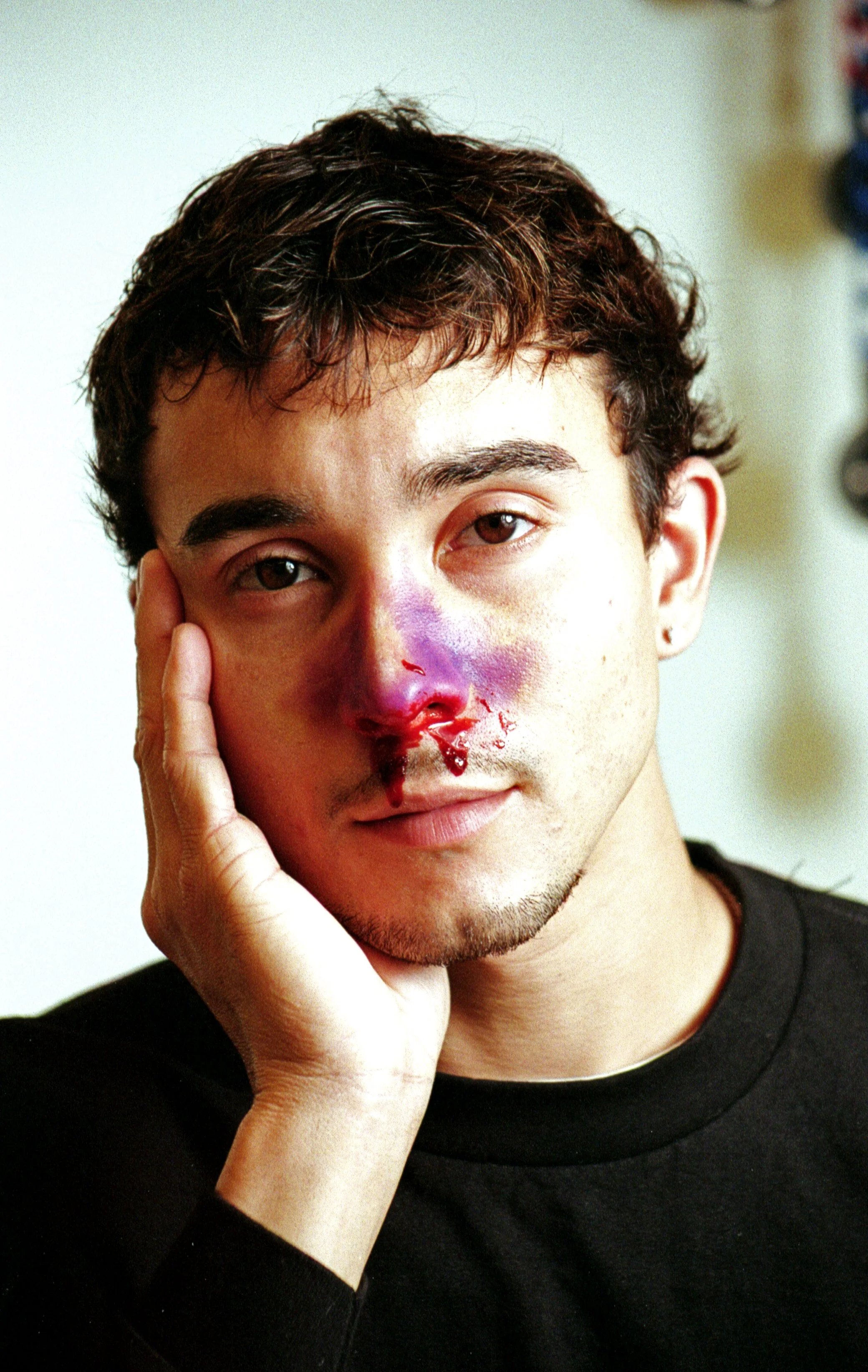 Brokennose_leo_01 copy.JPG