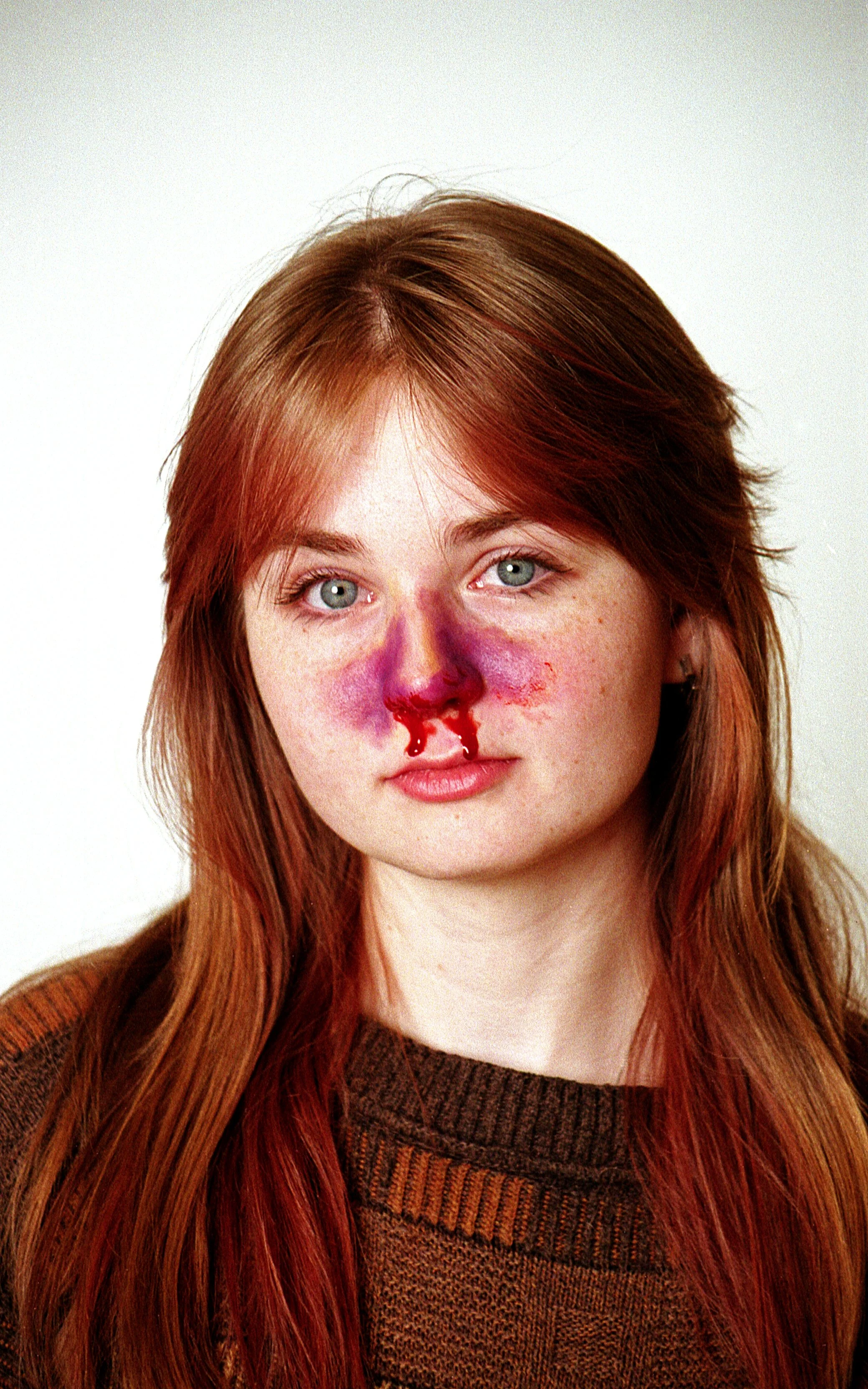 brokennose_lynn_02 copy.JPG
