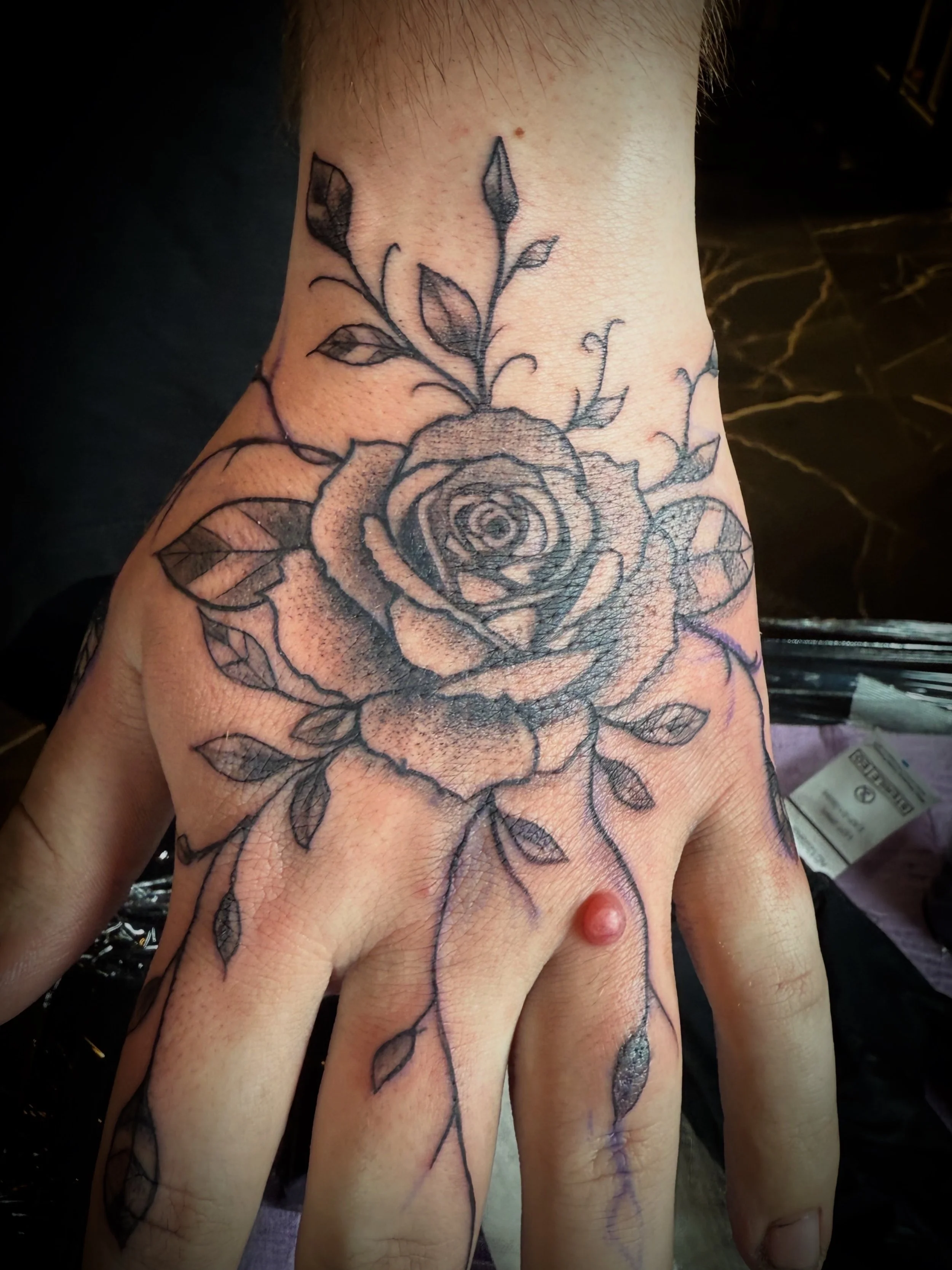 Close-up of a person's hand with a tattoo of a rose and leaves. The skin shows healing scars and stitches.