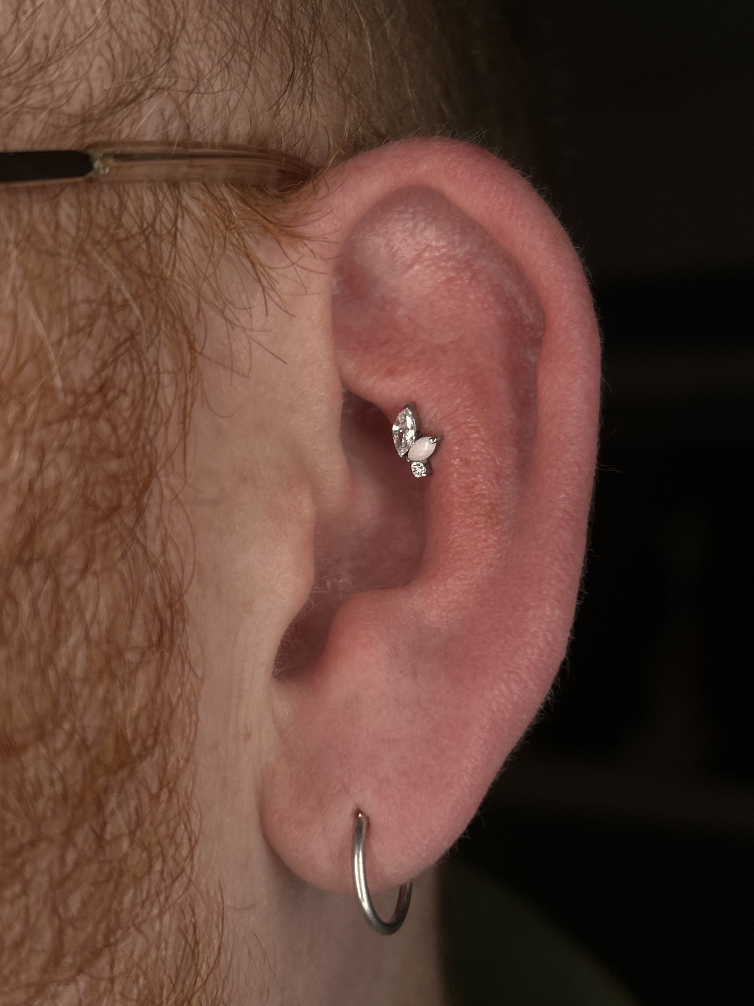 Close-up of a person's ear with a silver hoop earring and a mole on the earlobe.